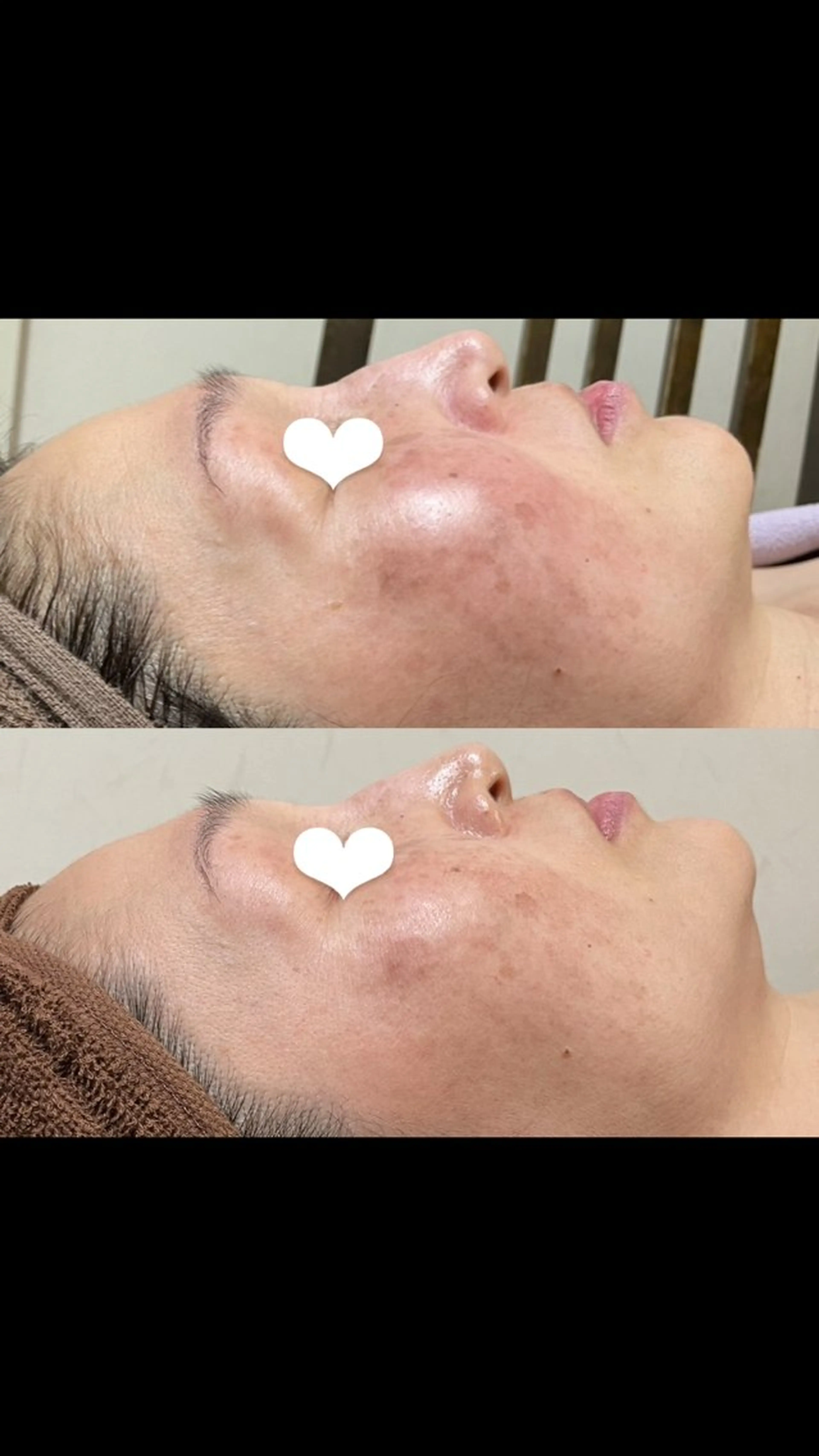 brilliance所属・老化肌トラブル肌専門 Brillianceのエステ・リラクイメージ