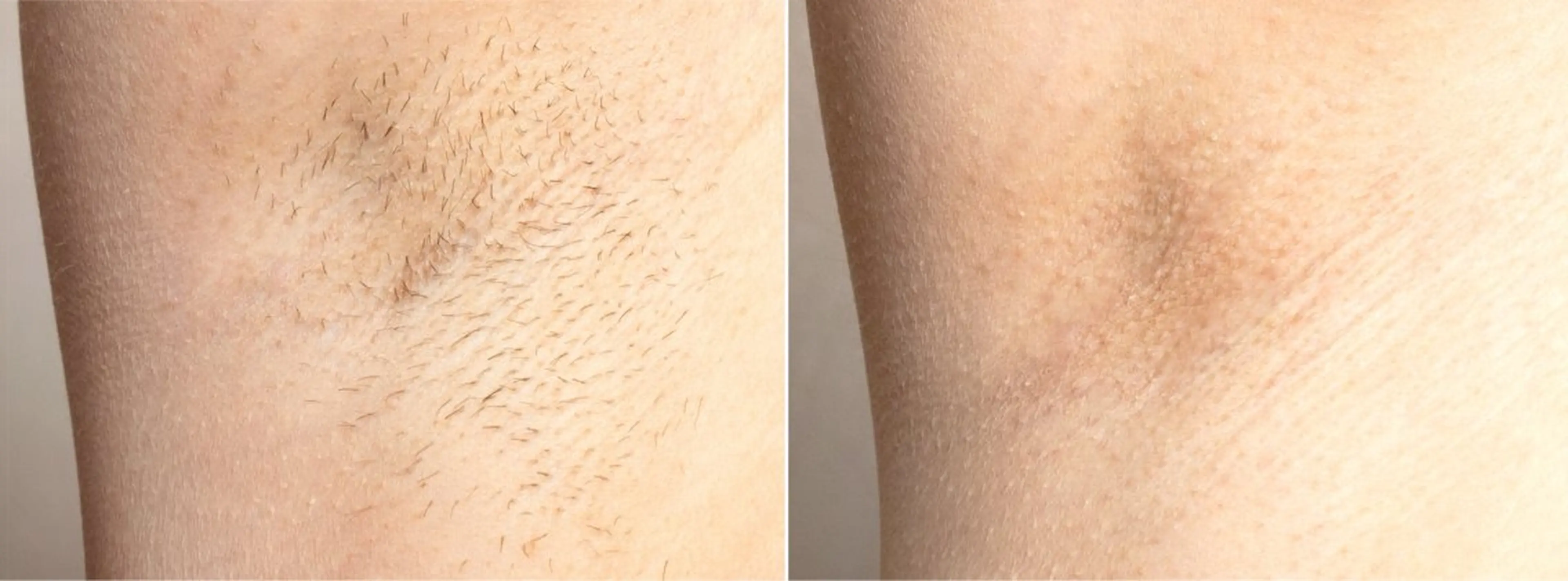 Victoireプチ所属・ヴィクトワール プチのエステ・リラクイメージ