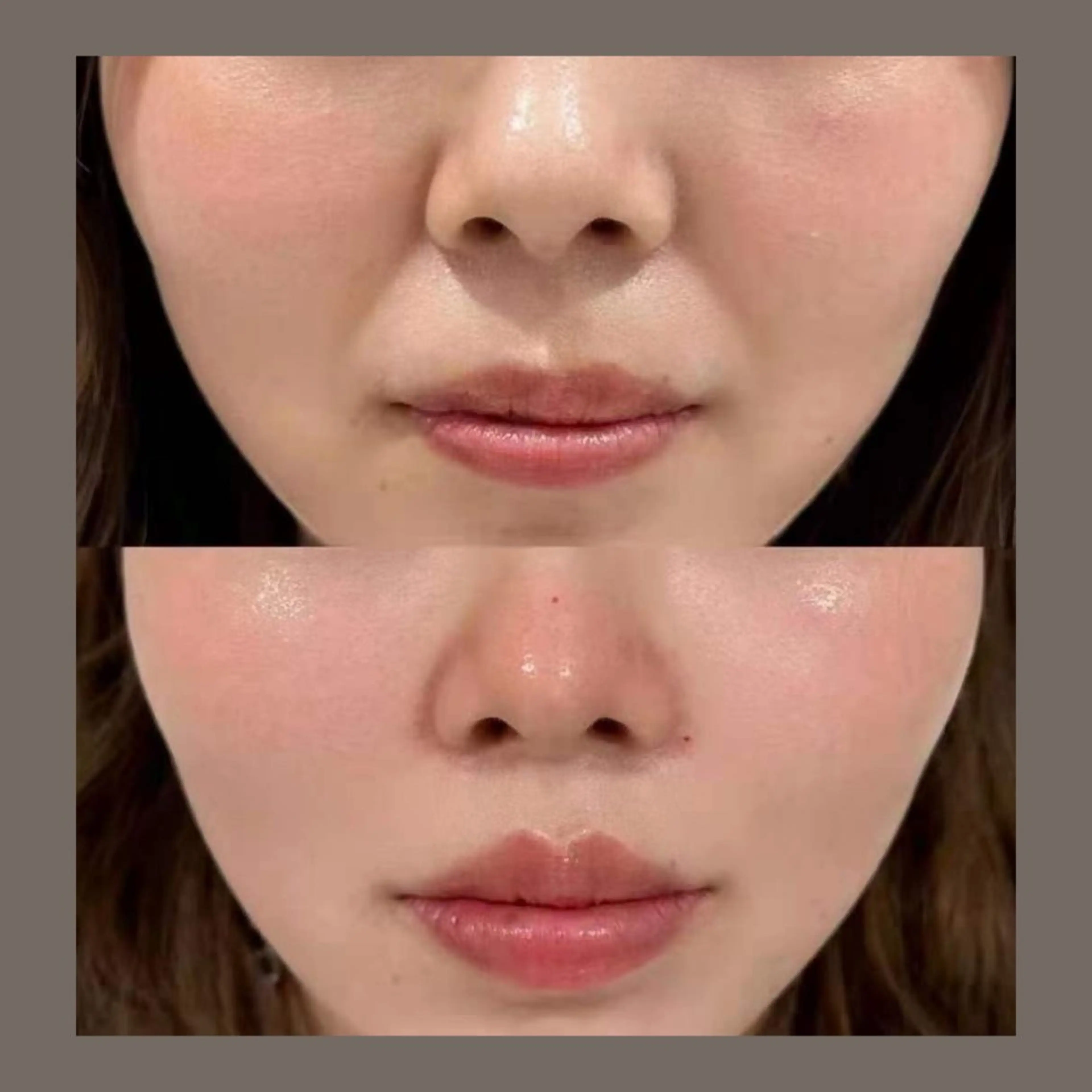 エステ リラク 愛維美水光美肌専門店所属・愛維美水光美肌専門店 メンズレディースokのエステ・リラクイメージ