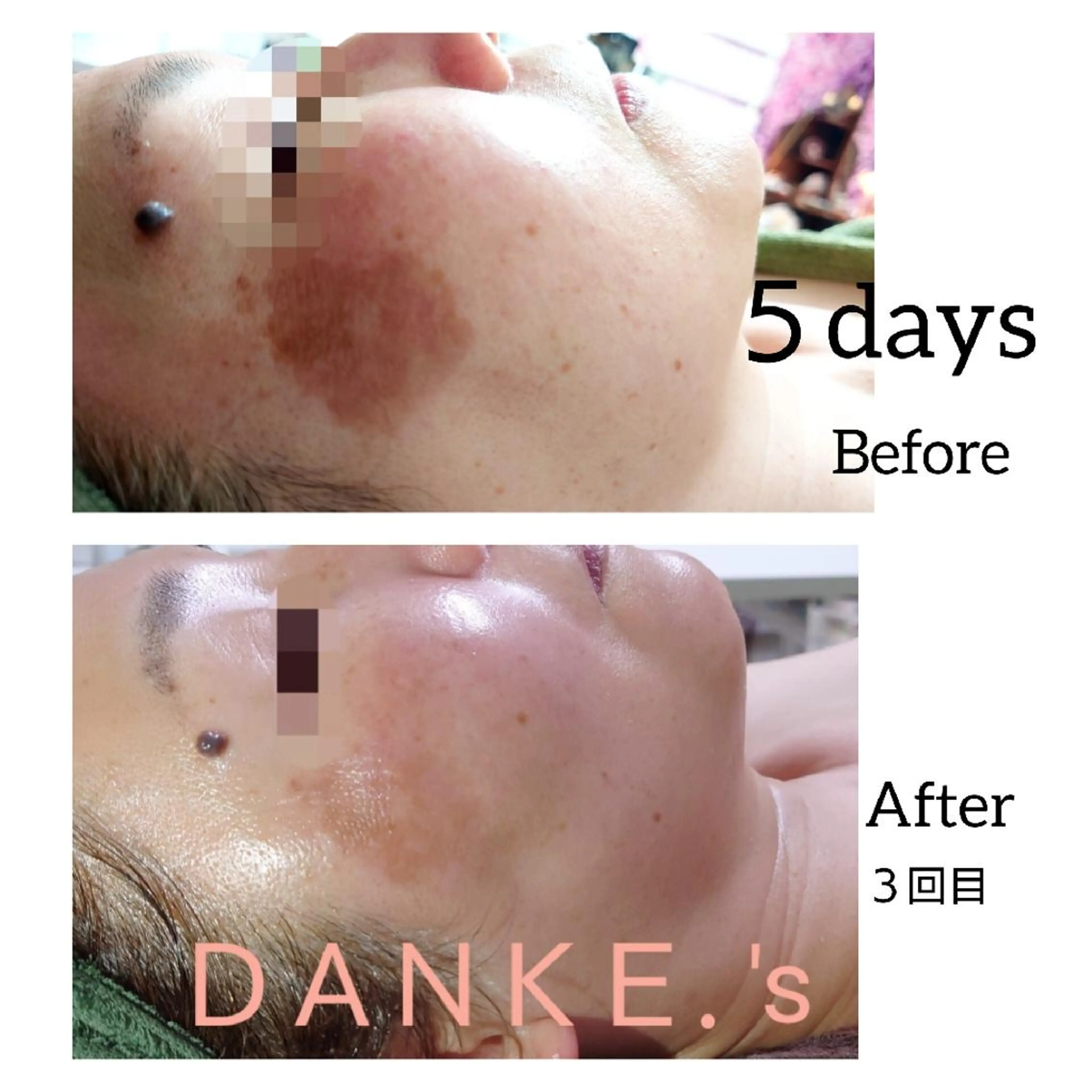 ＤＡＮＫＥ. サポートナースゆうこのエステ・リラクイメージ