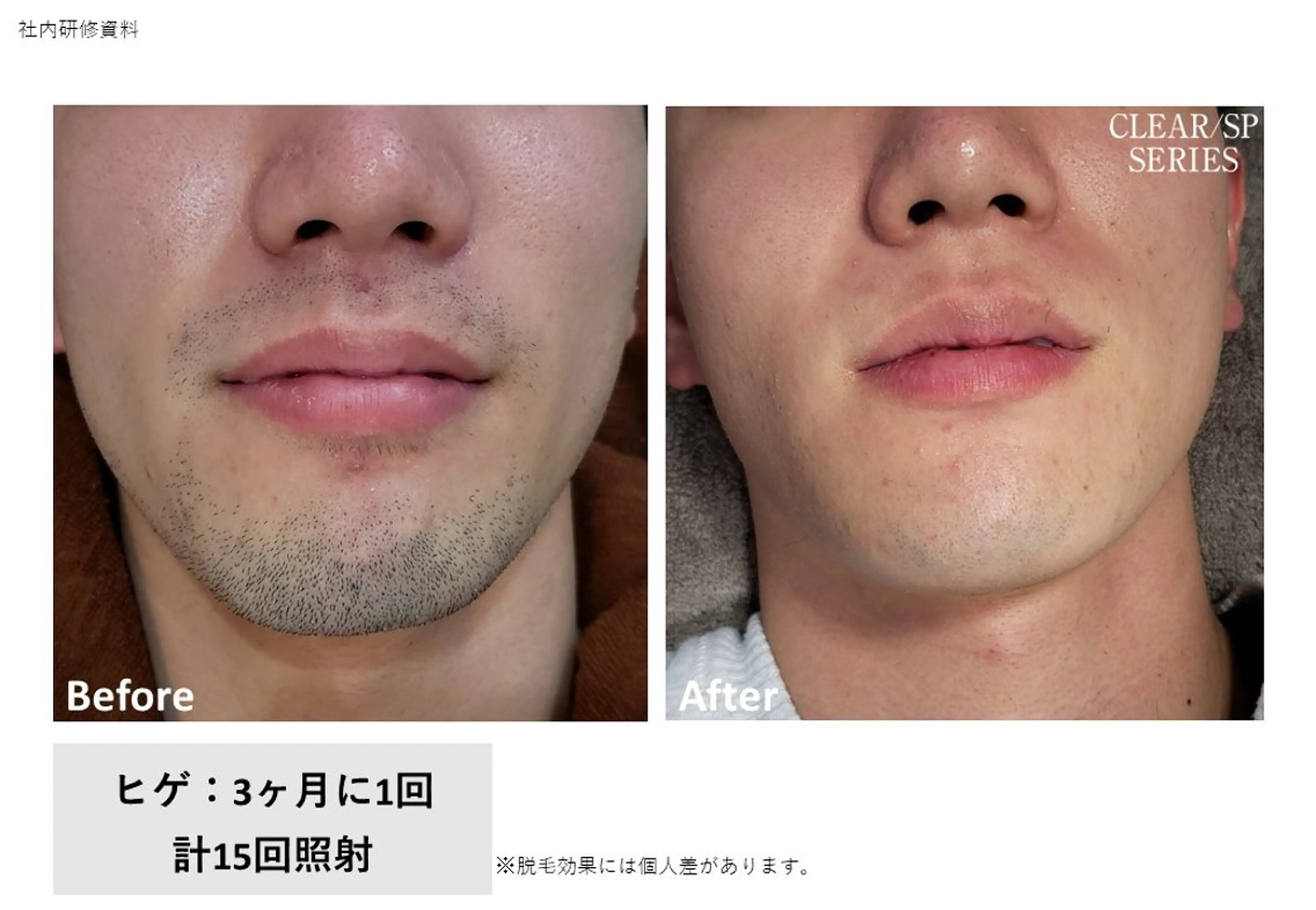 VIERU YURIのネイルデザイン