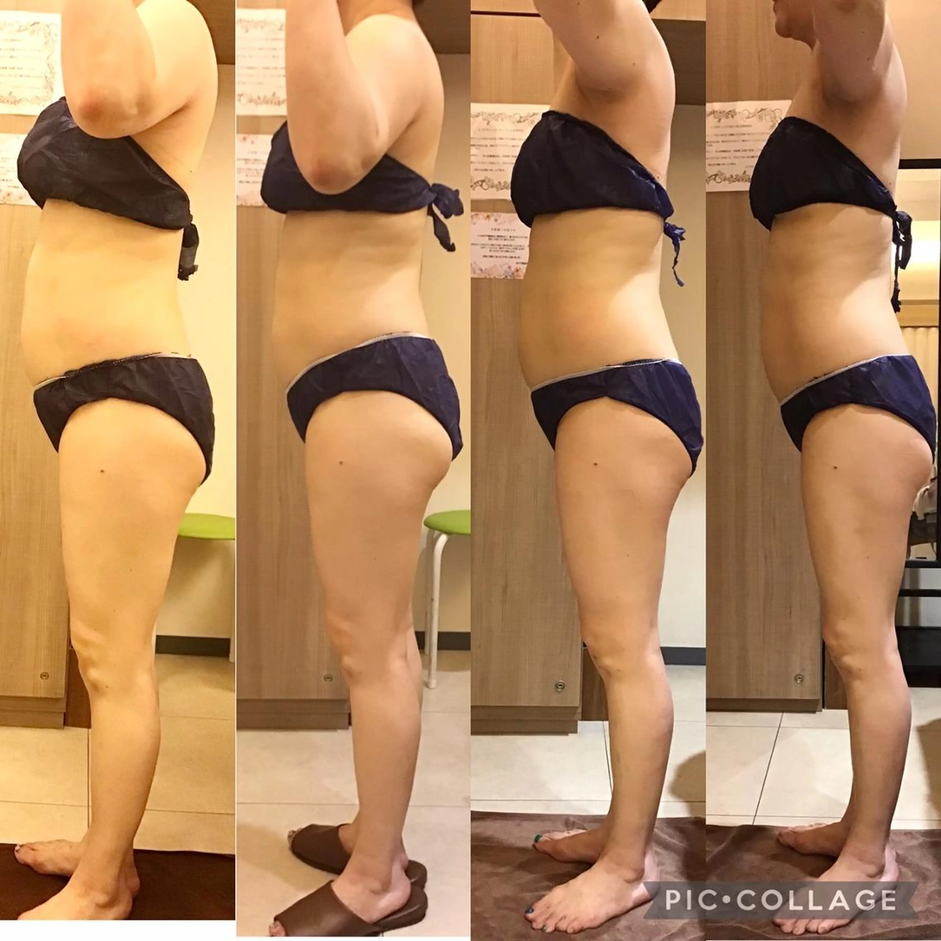 🧸12月来店限定🧸一度にボディ＆フェイシャルをお手入れ💆‍♀️全身つるピカになるオーダーメイドのエクストラケア✨の写真