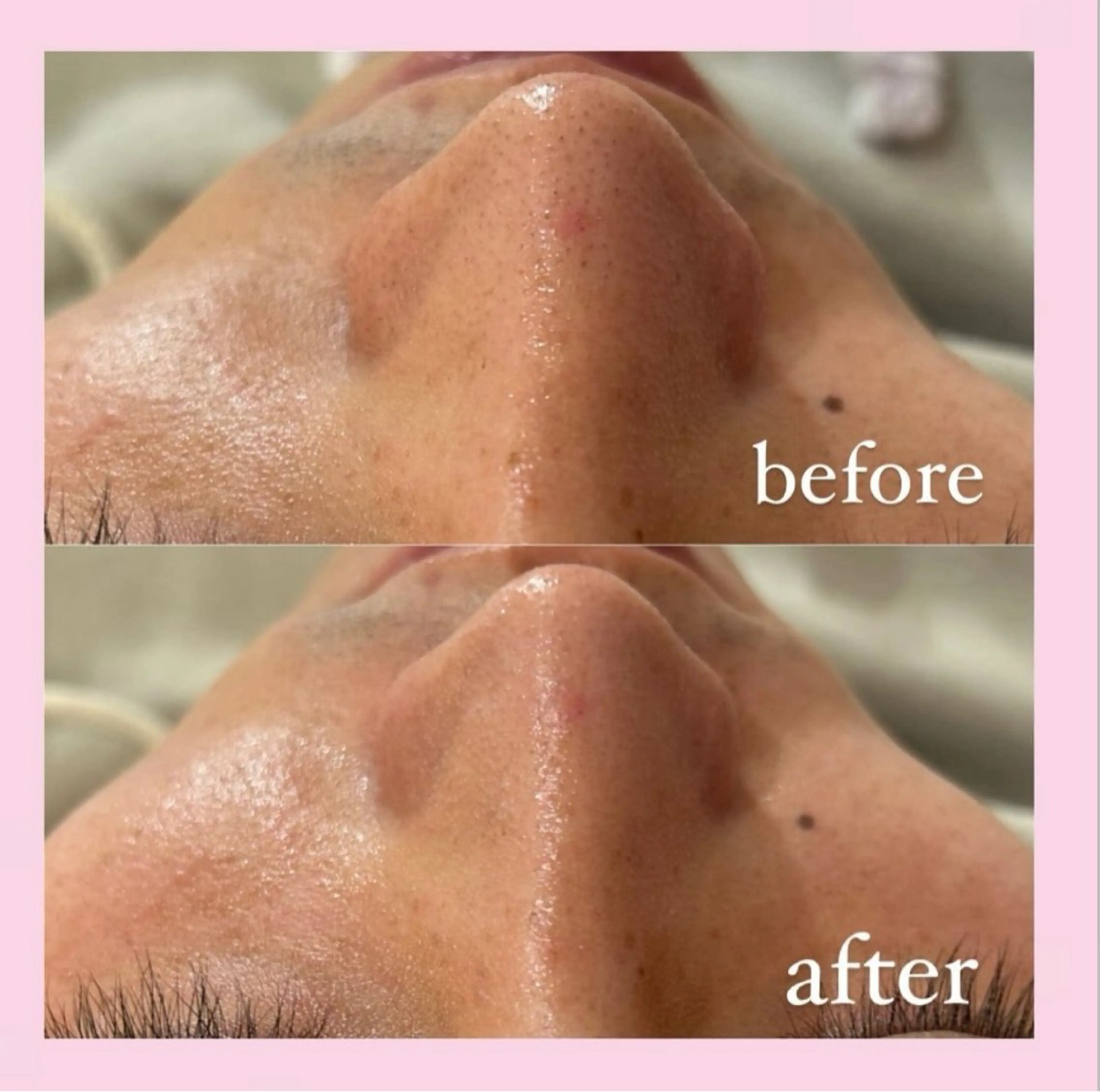 エステ 韓国肌管理専門店　White labo 宝塚店所属・有川 凜のエステ・リラクイメージ