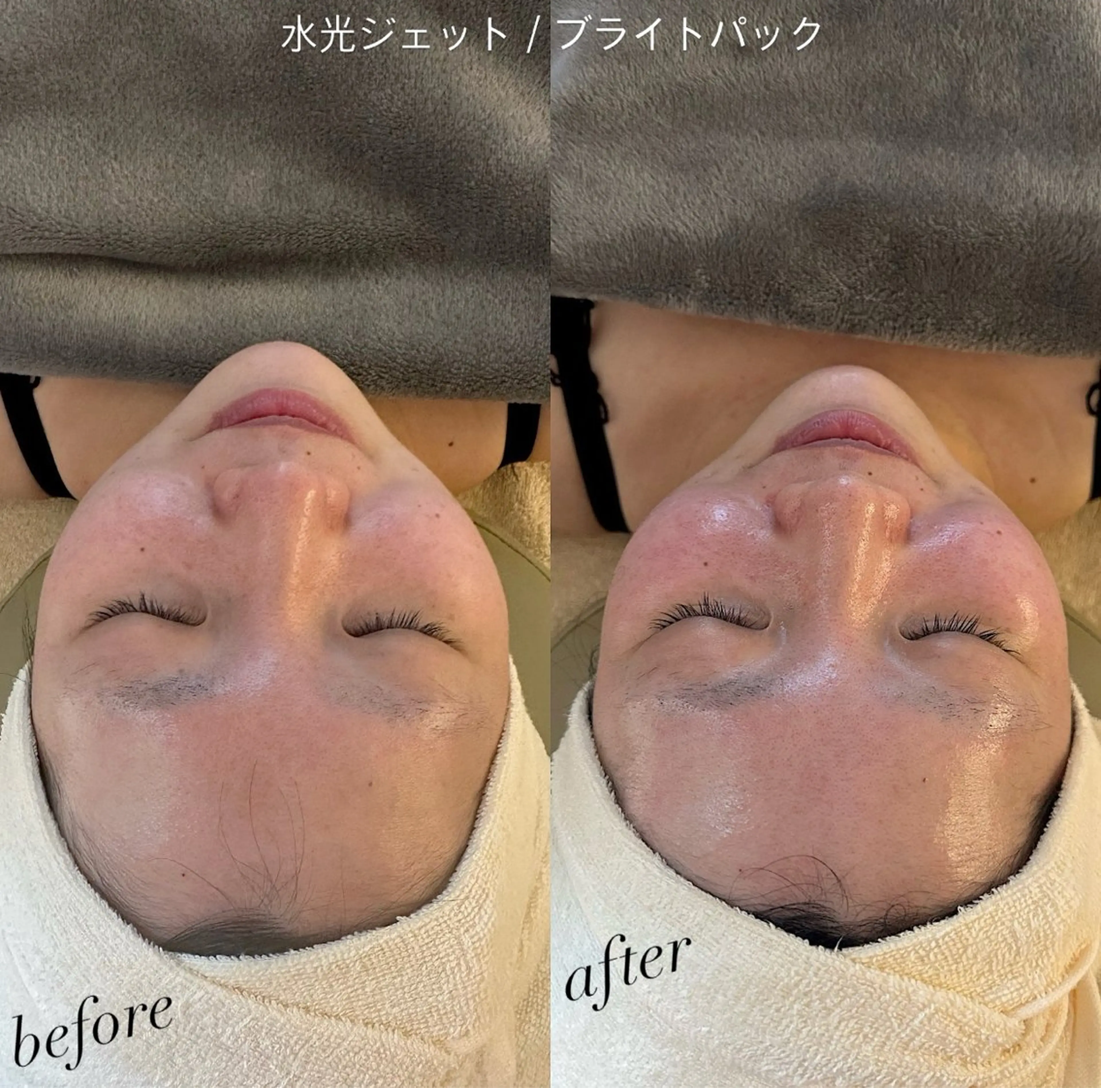 エステ うなじ脱毛/美肌脱毛 LABELのエステ・リラクイメージ