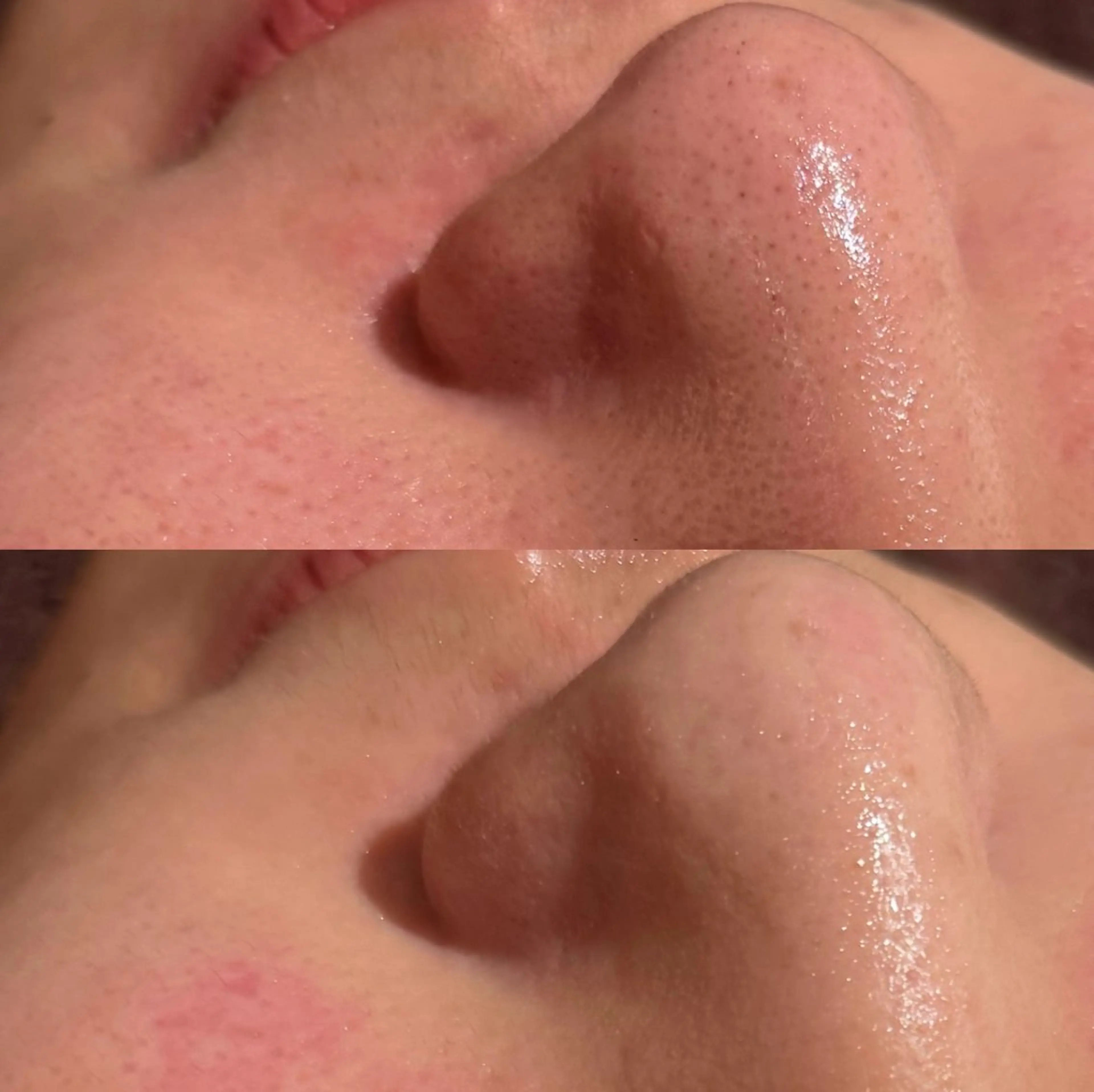 エステ for woman所属・森 美優のエステ・リラクイメージ