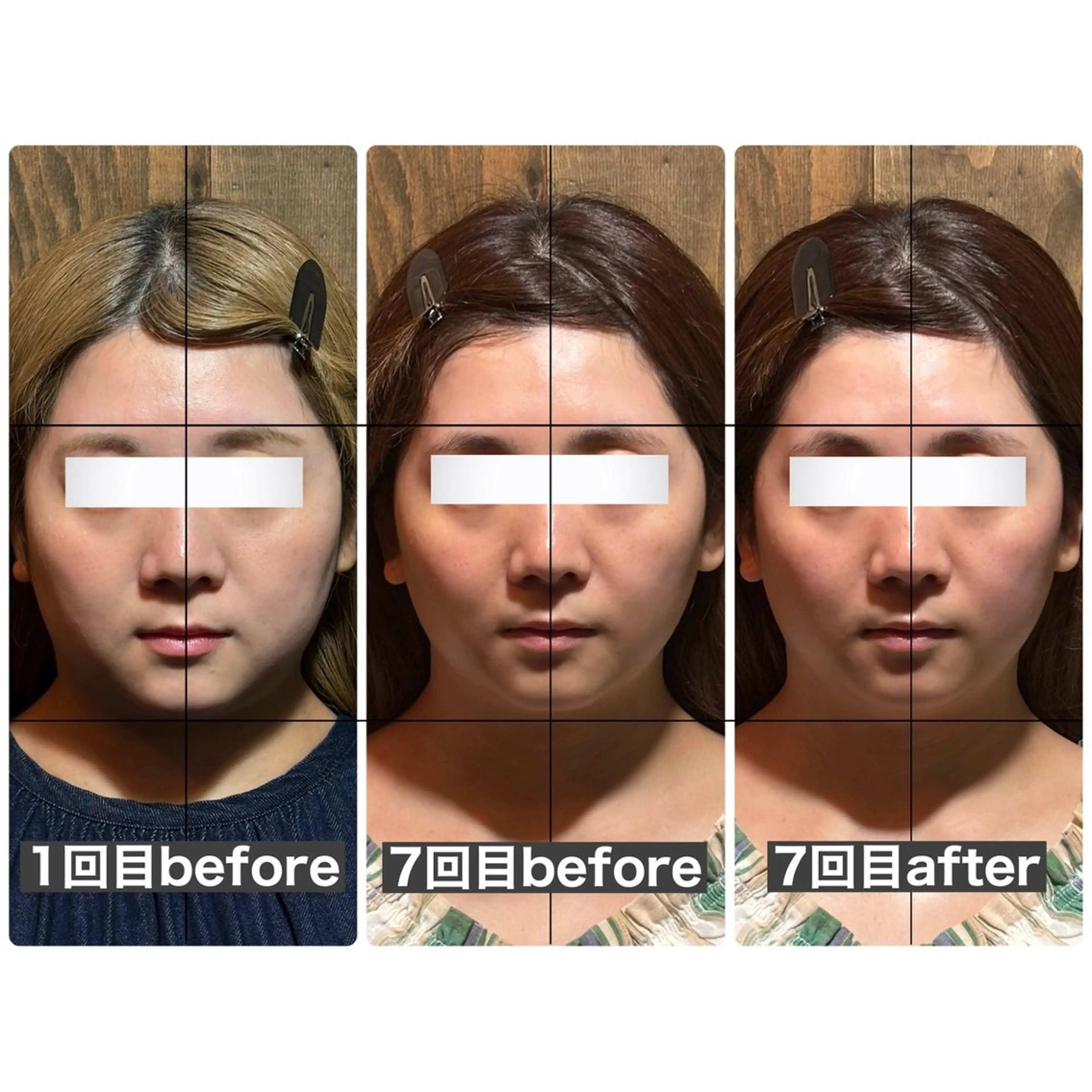 エステ リラク 💎後悔させない小顔 矯正💎イトヤマ🌱のエステ・リラクイメージ