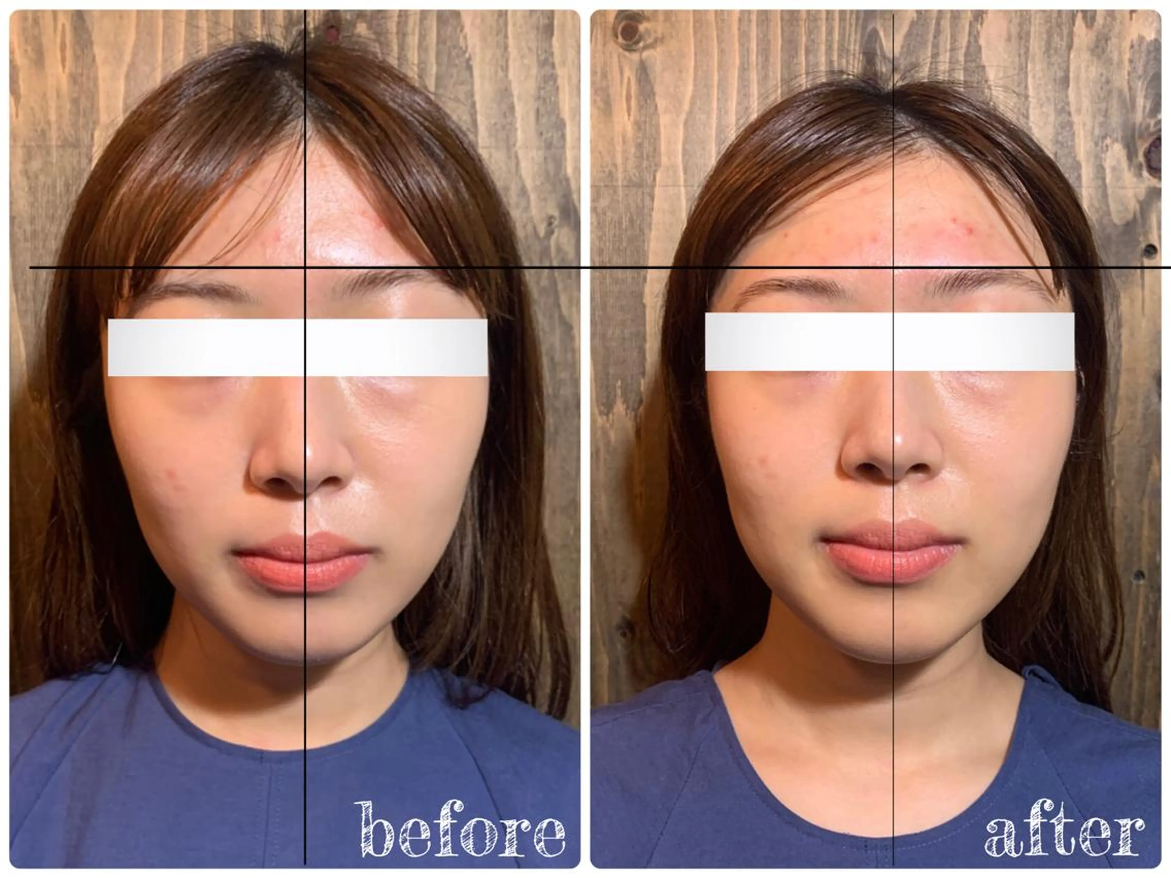 エステ リラク 💎後悔させない小顔 矯正💎イトヤマ🌱のエステ・リラクイメージ