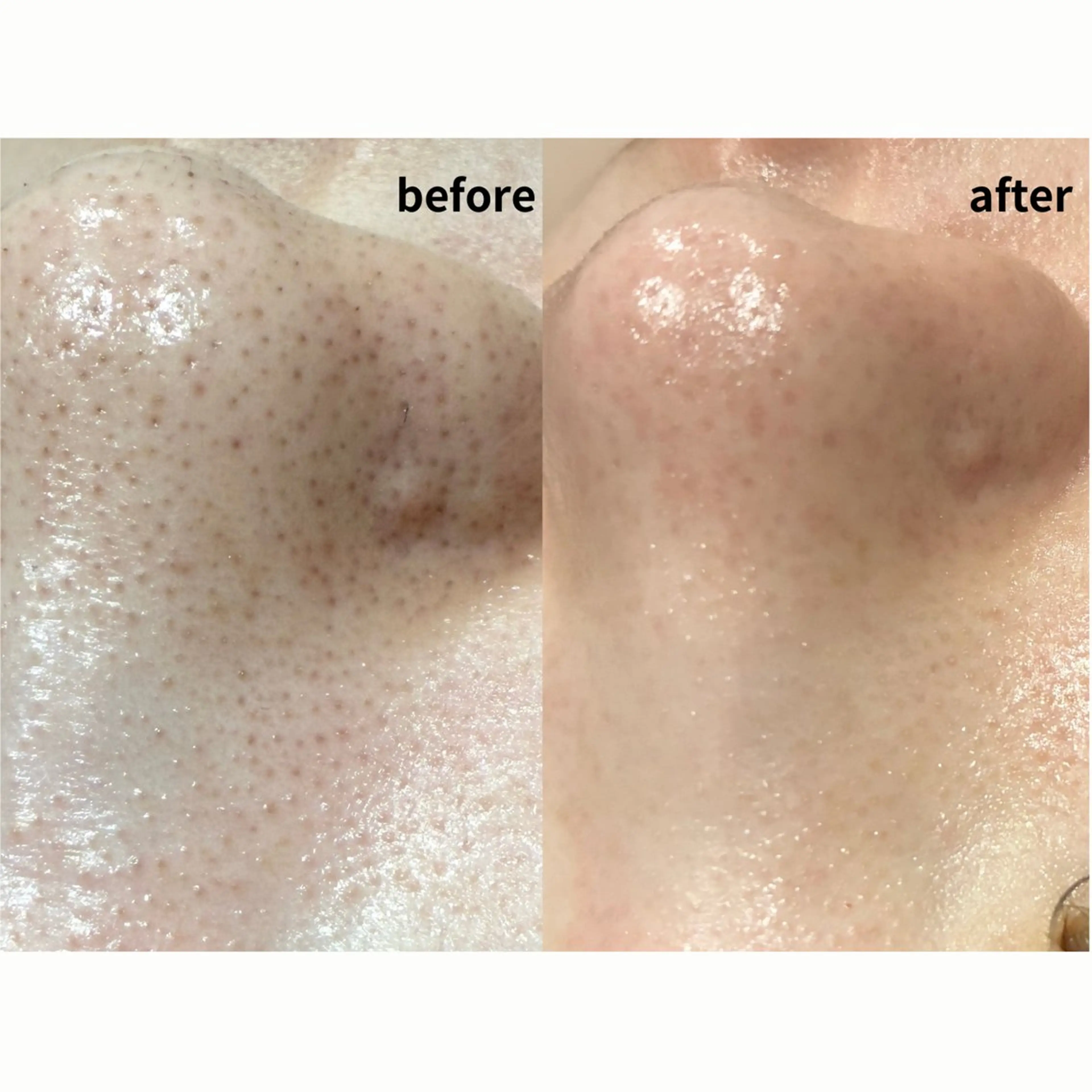 エステ DahliaBeauty ダリアビューティー所属・Dahlia痩身脱毛 フェイシャル 中村のエステ・リラクイメージ