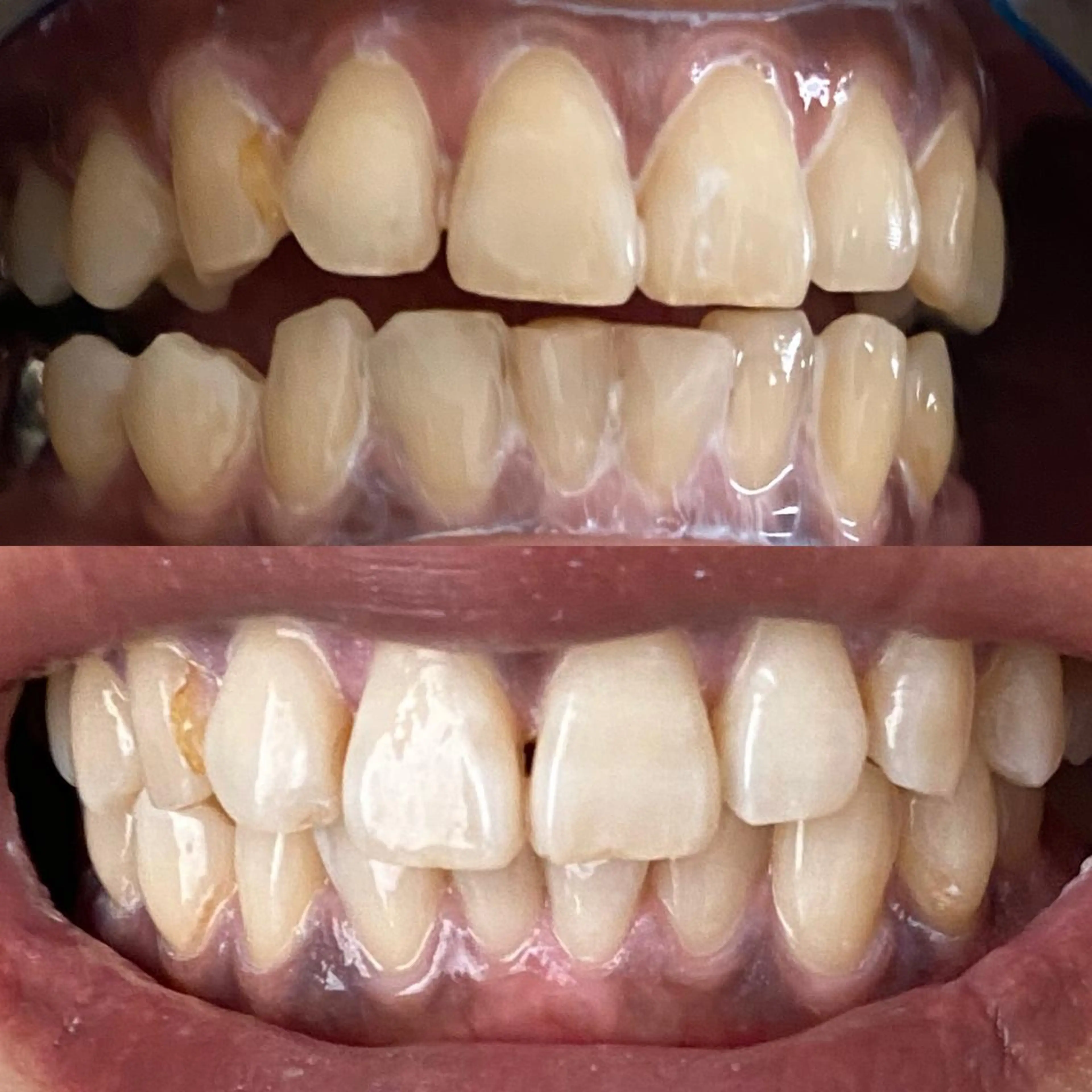 R E O T I A R A（レオティアラ）所属・高屋 昌子のその他イメージ