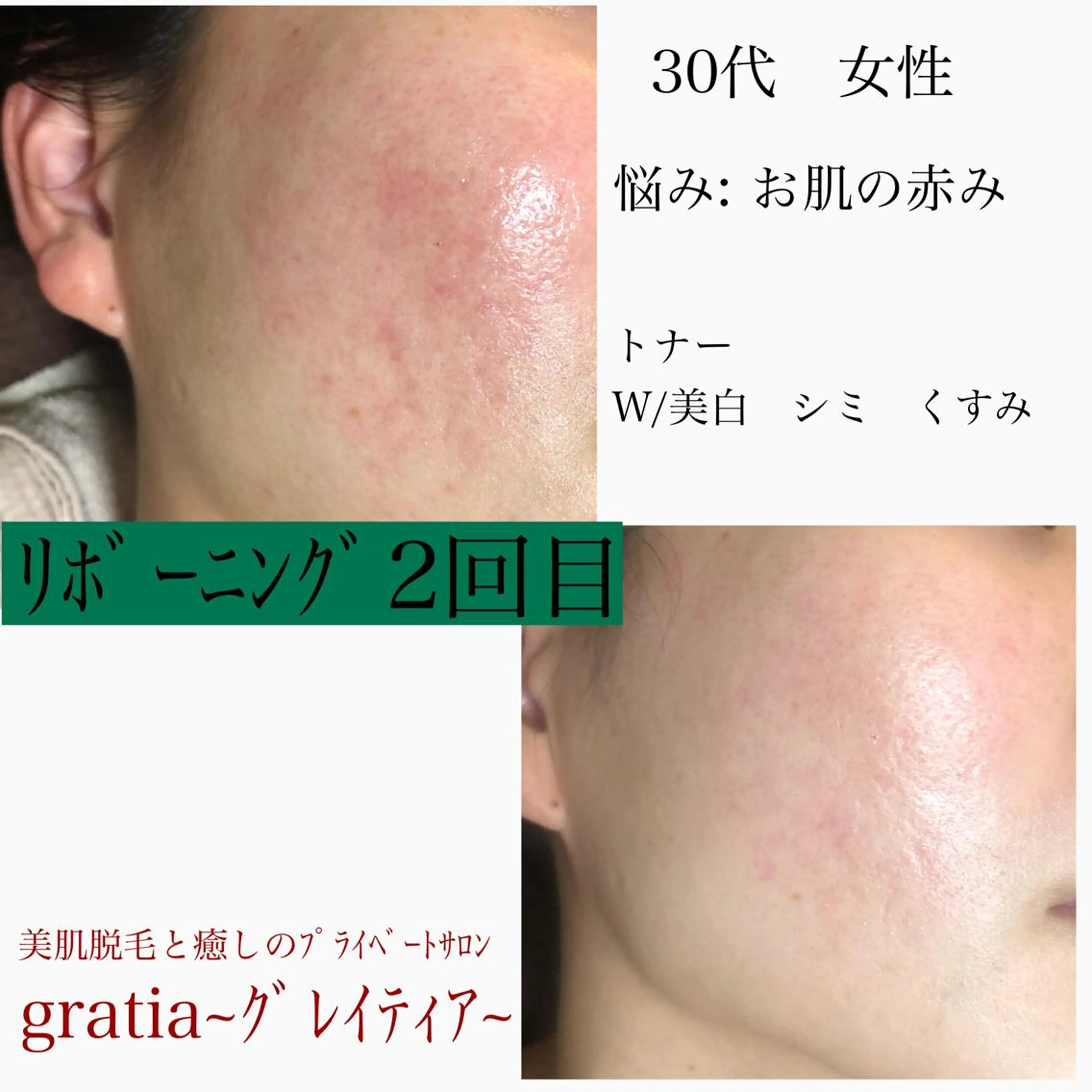 美肌脱毛と癒しのﾌﾟﾗｲﾍﾞｰﾄｻﾛﾝ。gratia~ｸﾞﾚｲﾃｨｱ~所属・gratia ~ｸﾞﾚｲﾃｨｱ~のエステ・リラクイメージ