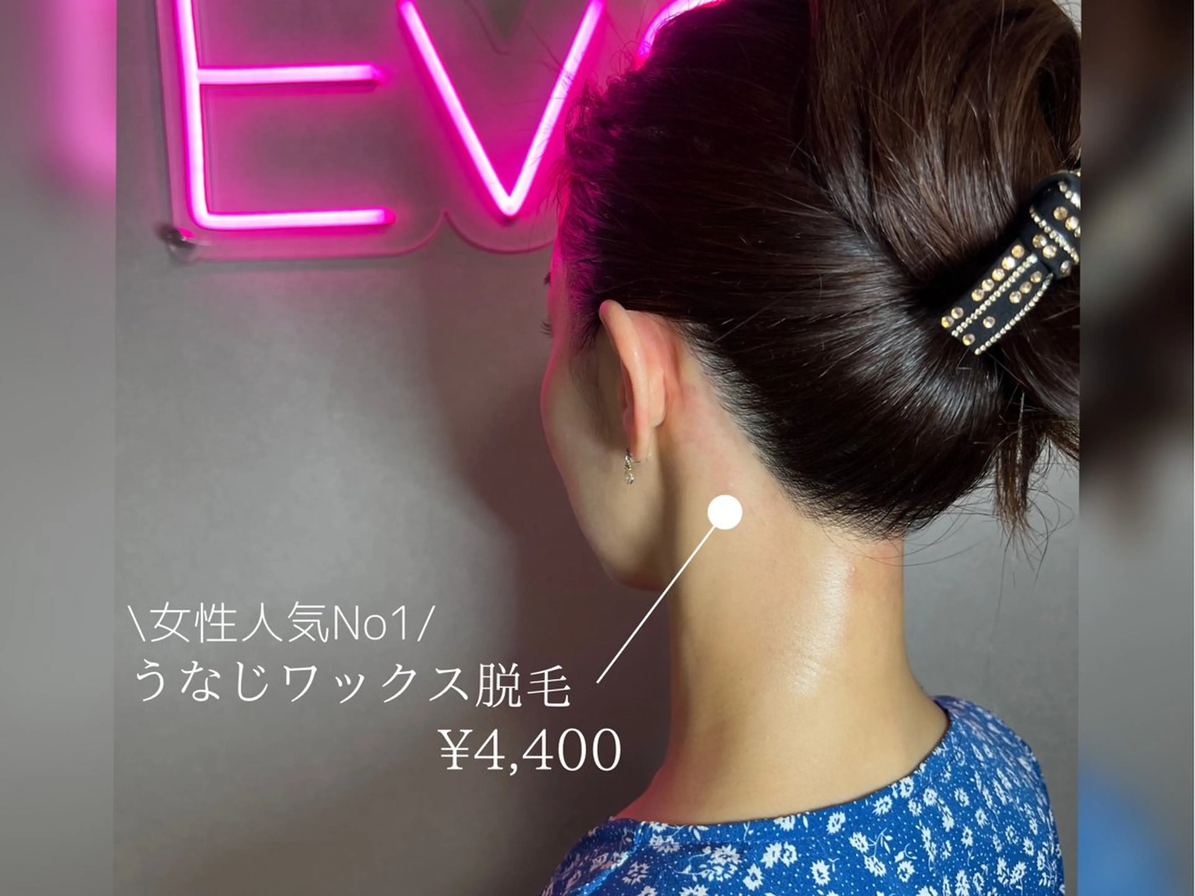 【ブライダル準備💒やまとめ髪👱🏻‍♀️が多い方】オススメうなじワックス¥4,400(ダブル脱毛なら¥7,800)の写真