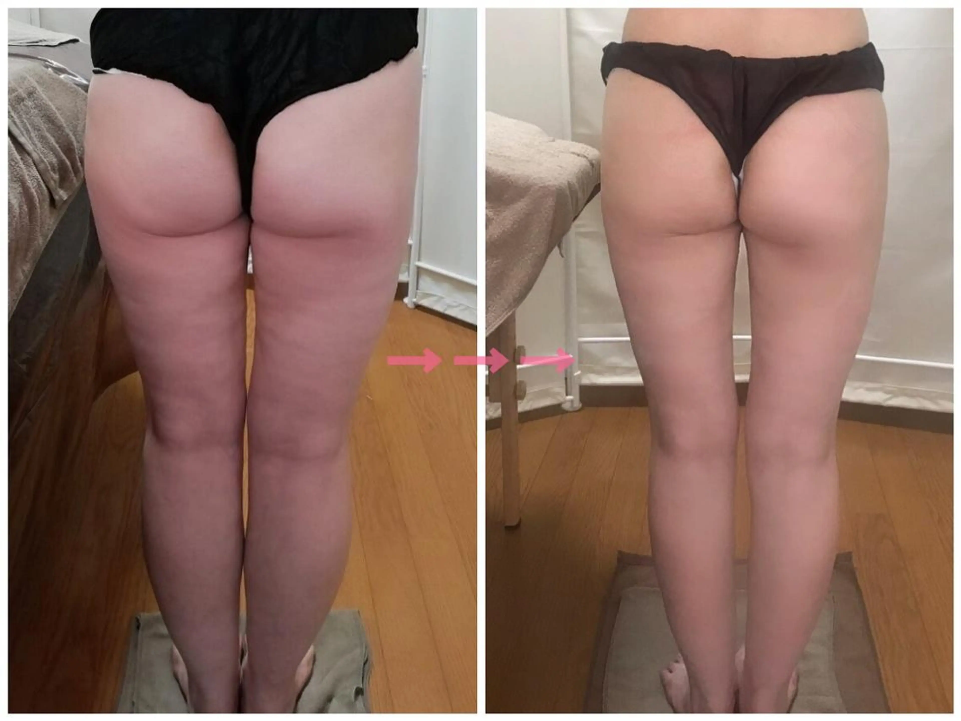 biloop所属・《痩身×疲労改善》 BILOOPのエステ・リラクイメージ