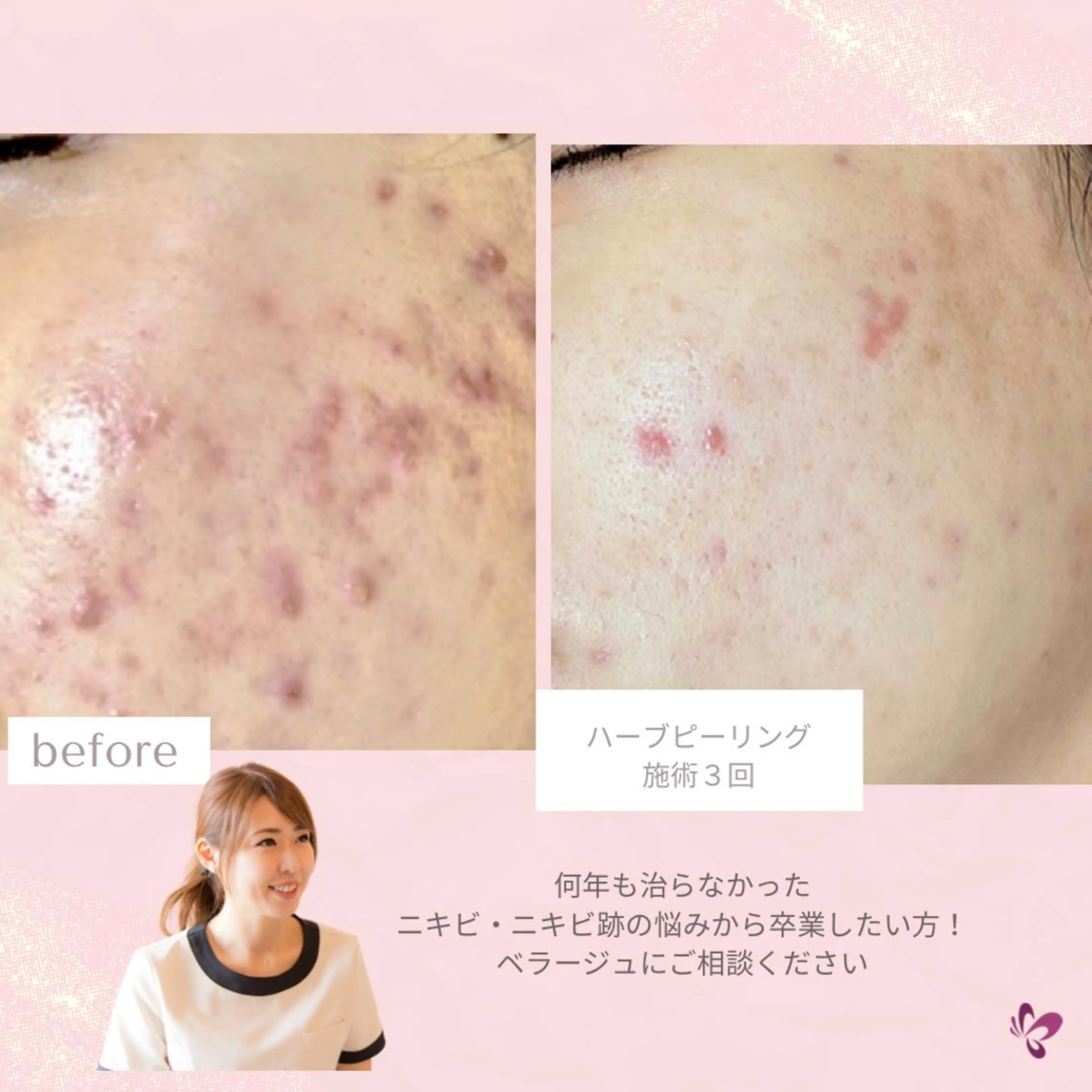 ベラージュ【美背中・ 美尻・フェイシャル】のエステ・リラクイメージ