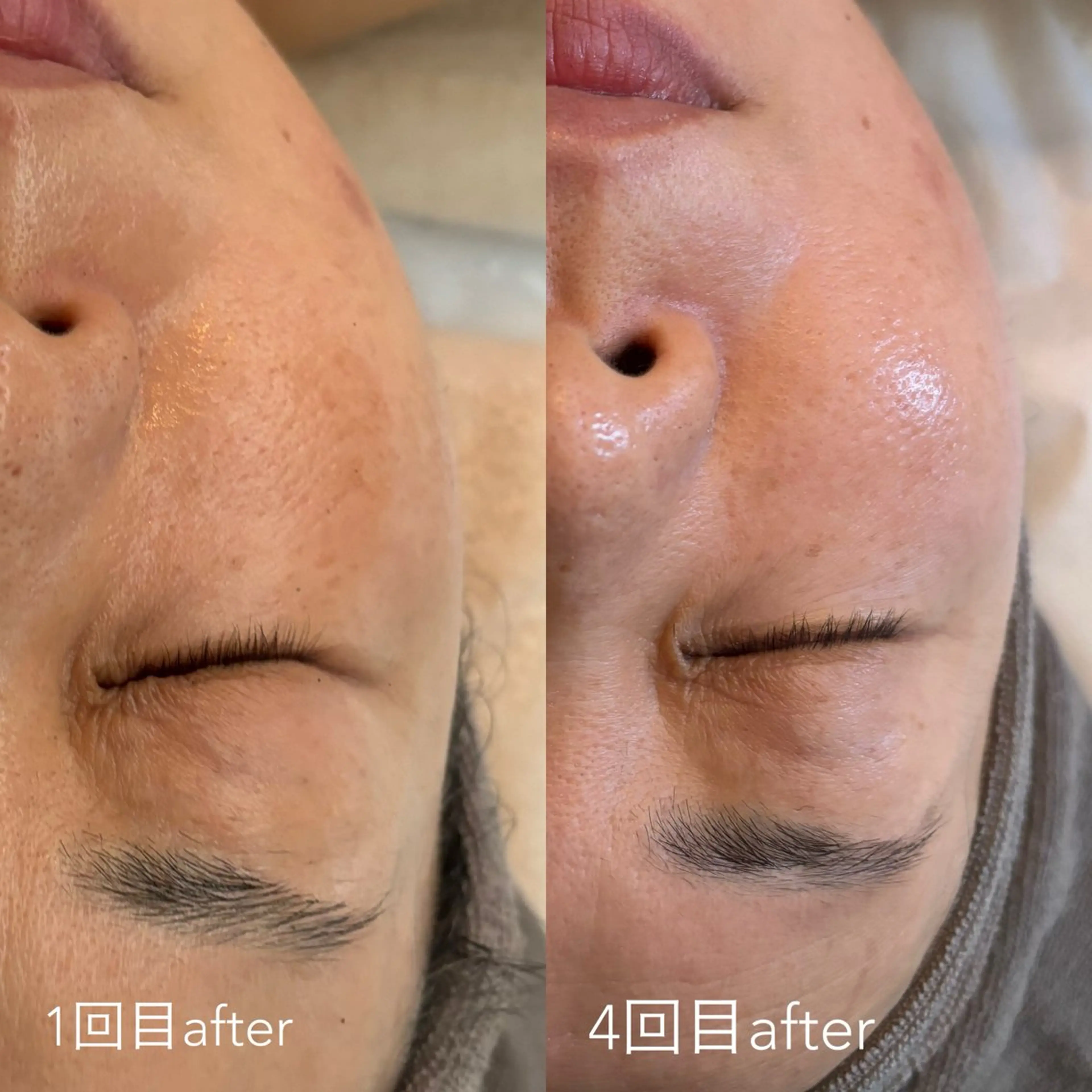 エステティックサロン Liente(リアンテ)所属・Hashimoto .のエステ・リラクイメージ