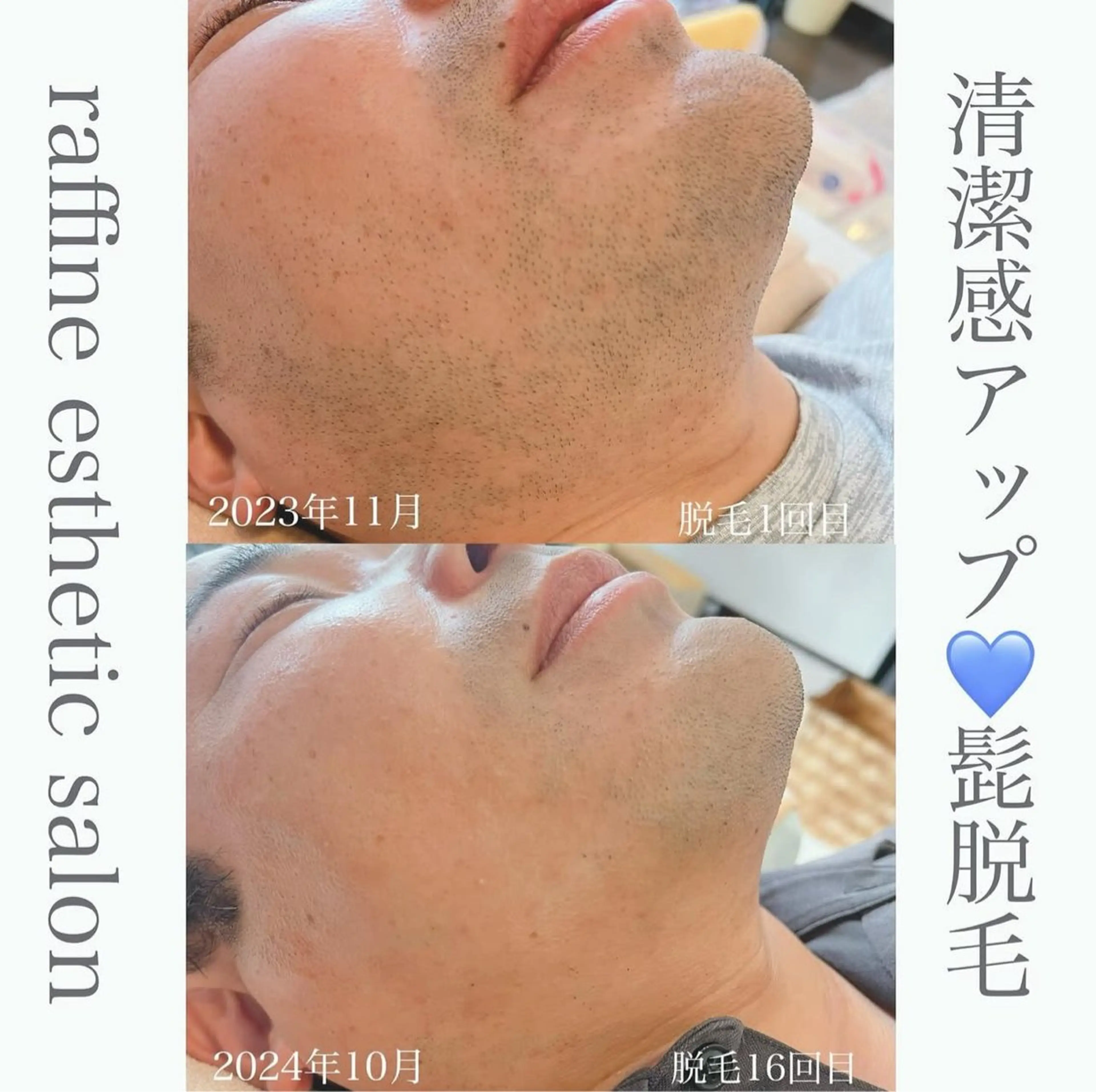 raffine  esthetic salon所属・🌻raffine 脱毛/まつ毛/ヘアーのエステ・リラクイメージ