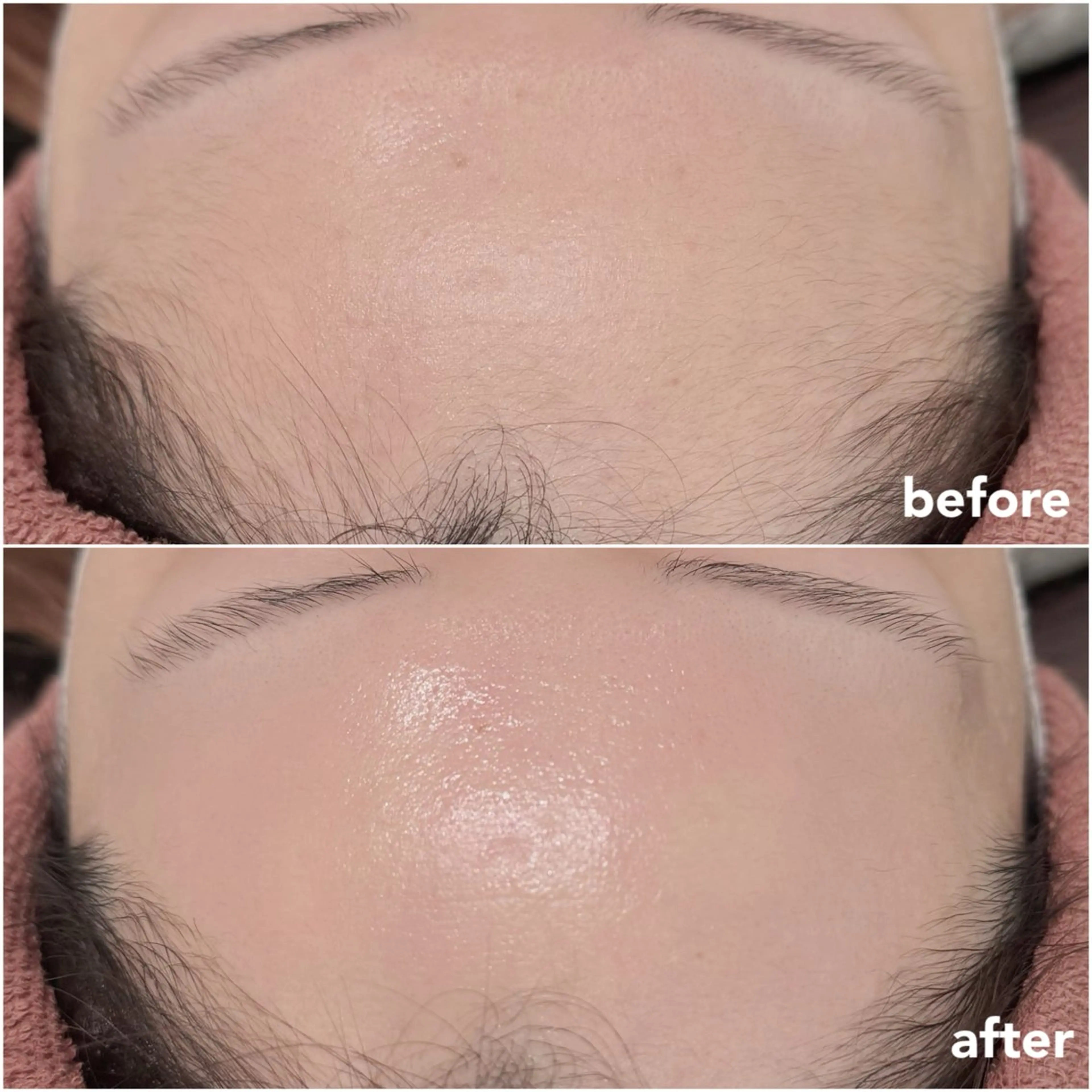 REVE （レーヴ）のマツエク・マツパデザイン