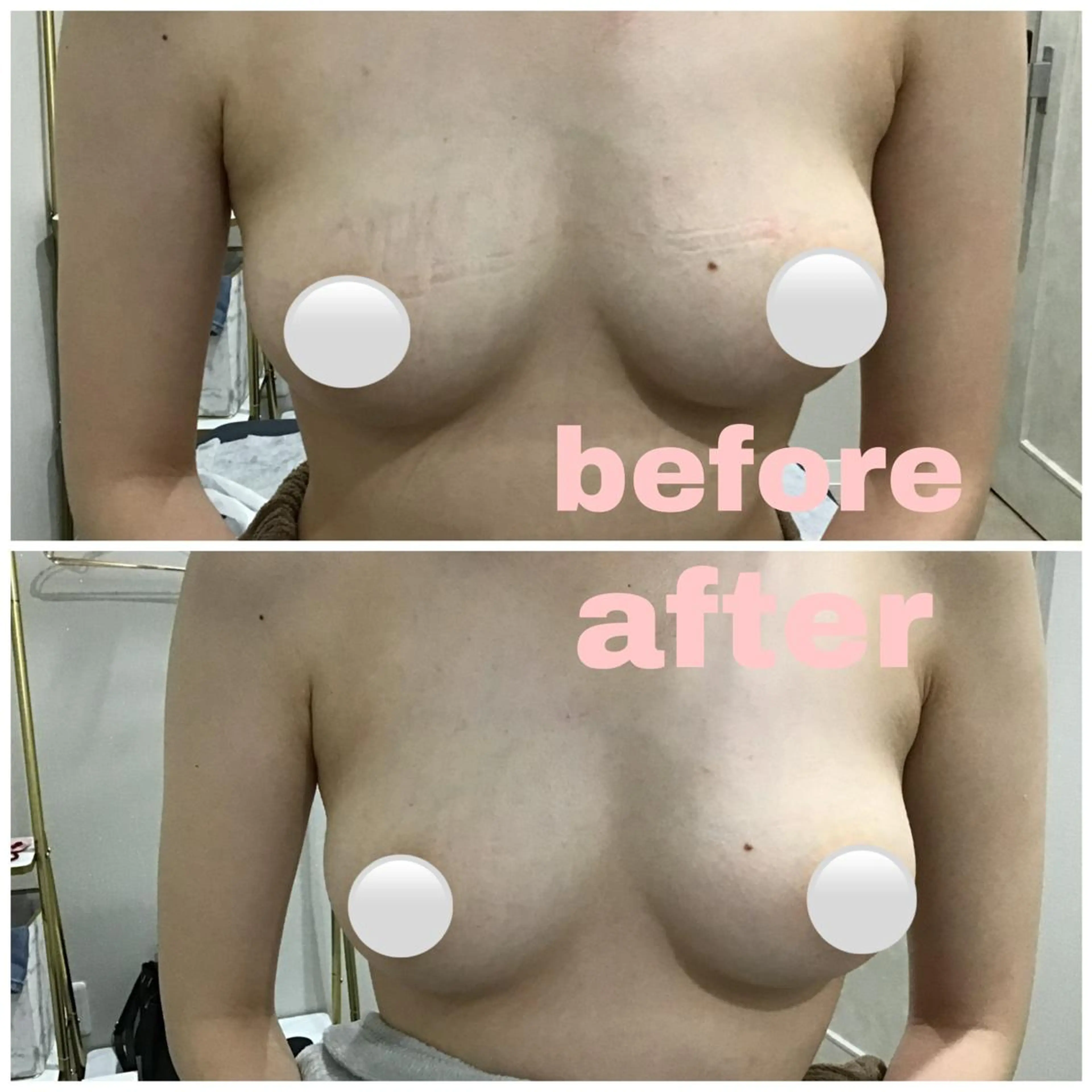 アルカンジュ~archange~所属・痩身/毛穴洗浄/脱毛 アルカンジュのエステ・リラクイメージ