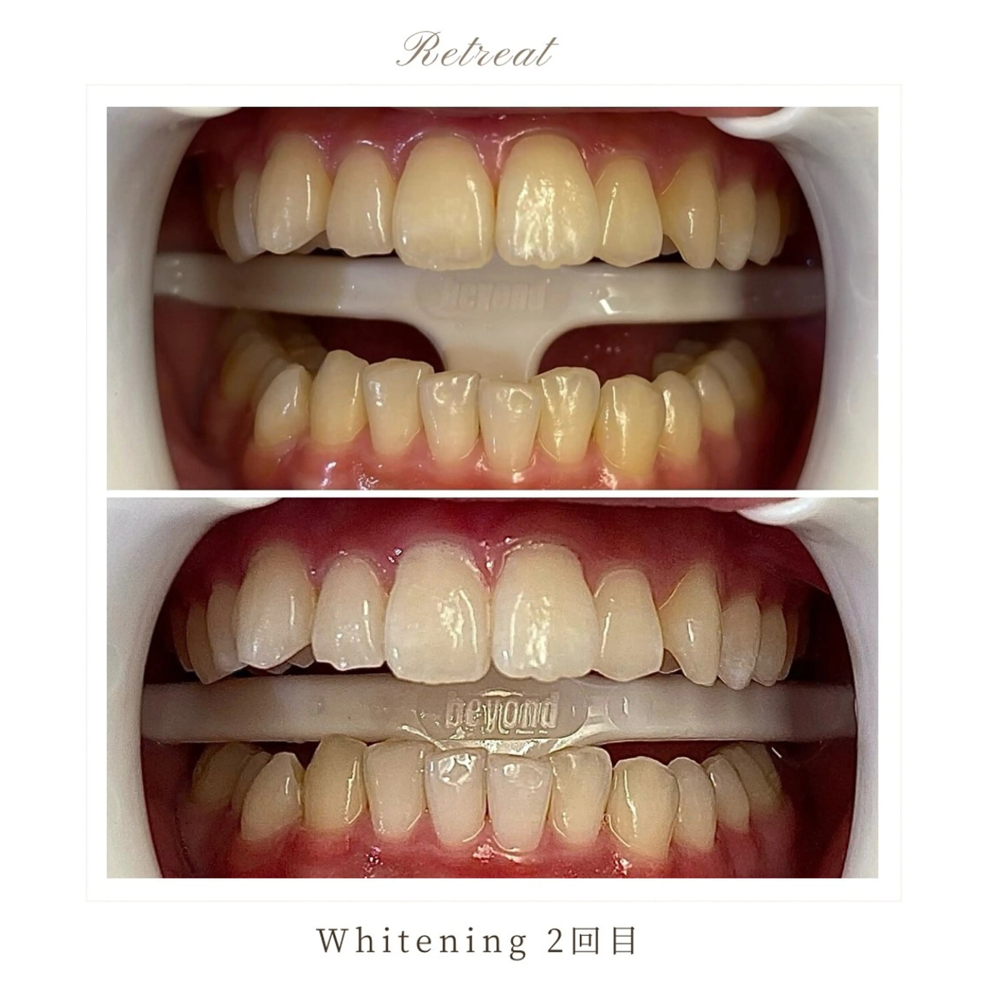 Retreatリトリート所属・歯科医院提携 Retreatのエステ・リラクイメージ