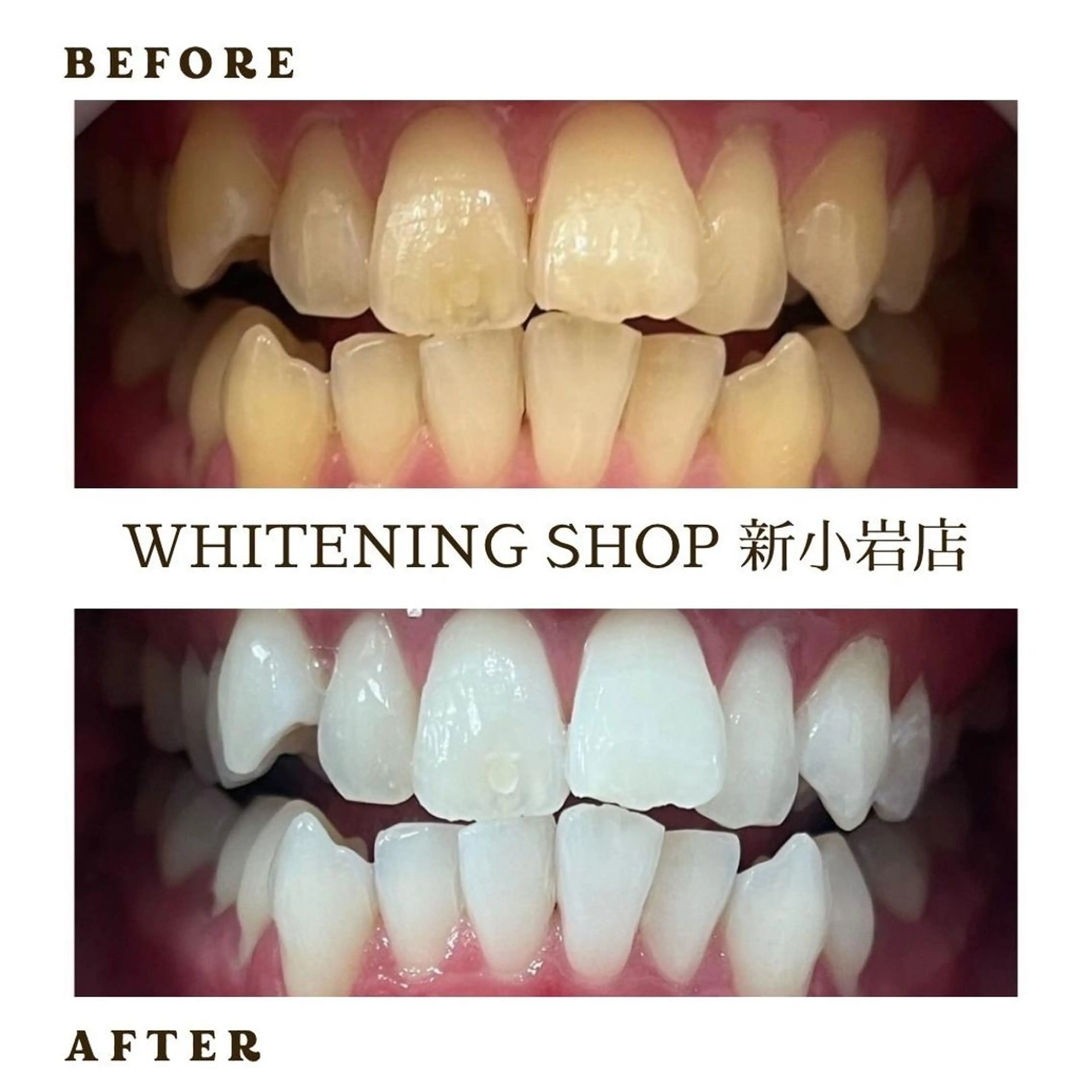 メンズ その他 ホワイトニング ショップ新小岩店のその他イメージ