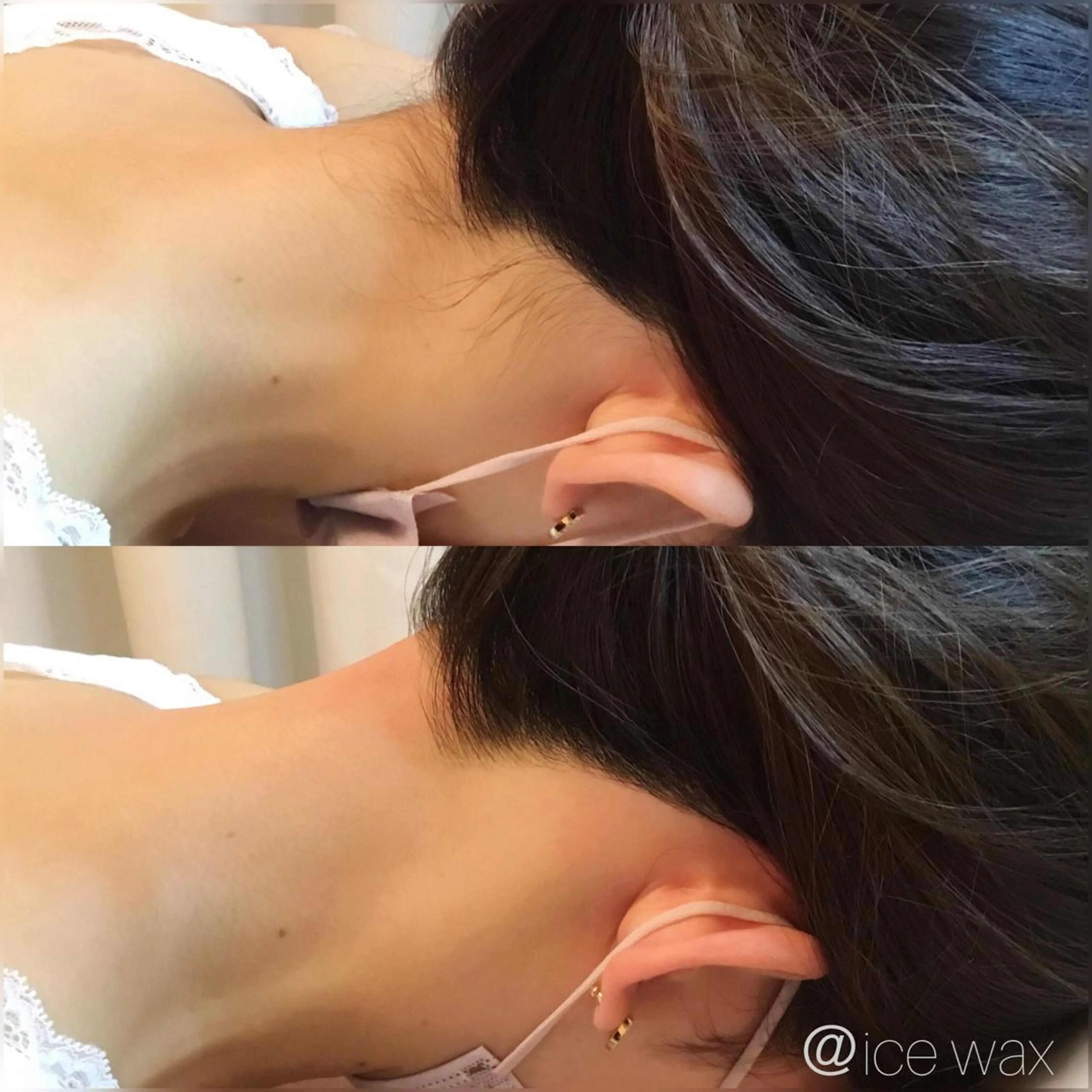 脱毛 SHIKI モリンガ蒸し/水光肌のエステ・リラクイメージ