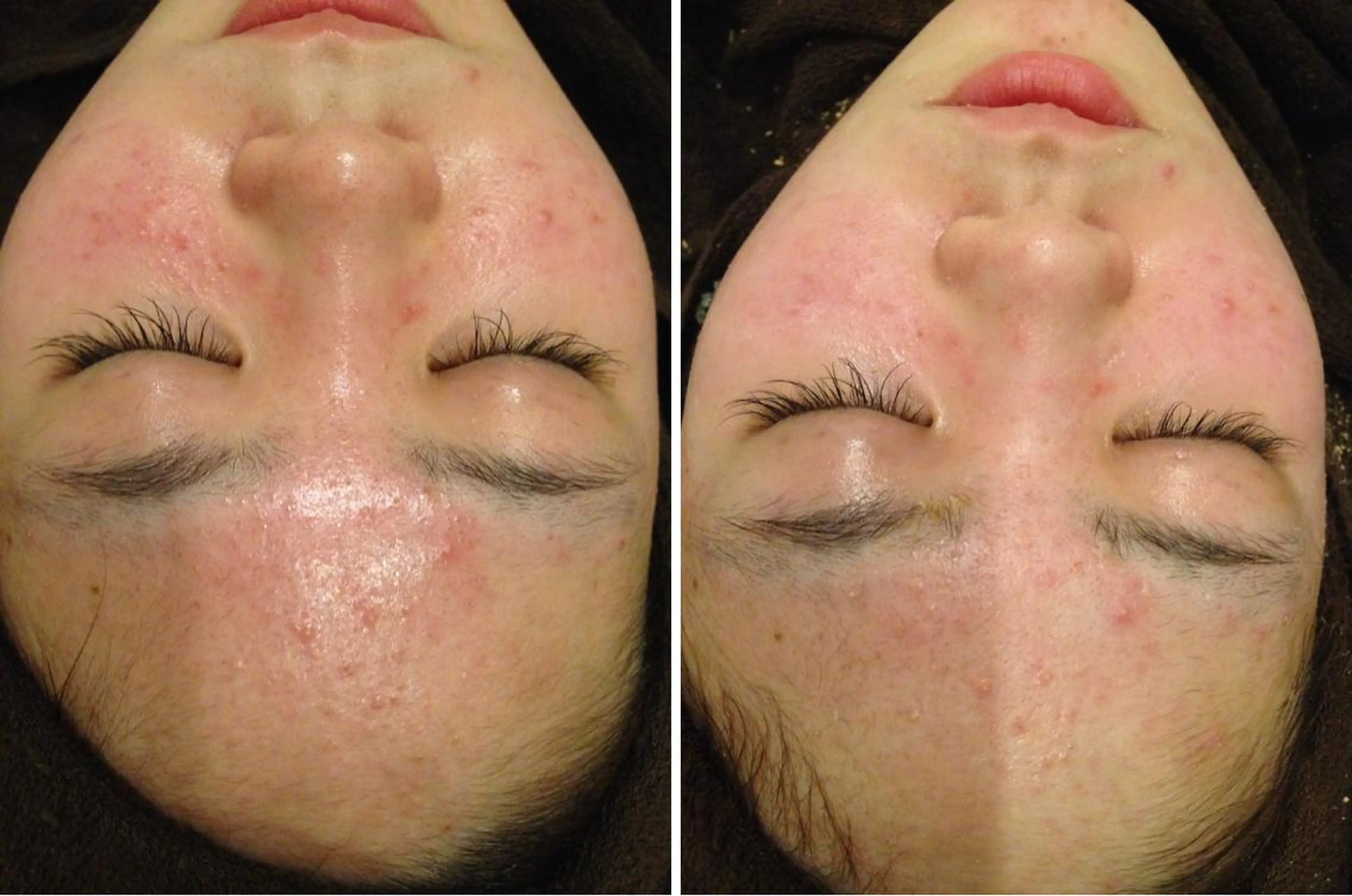 セミロング カラー パーマ ヘアアレンジ メンズ キッズ ネイル マツエク・マツパ アニメ,Vオタク× 即効痩せエステサロンのエステ・リラクイメージ