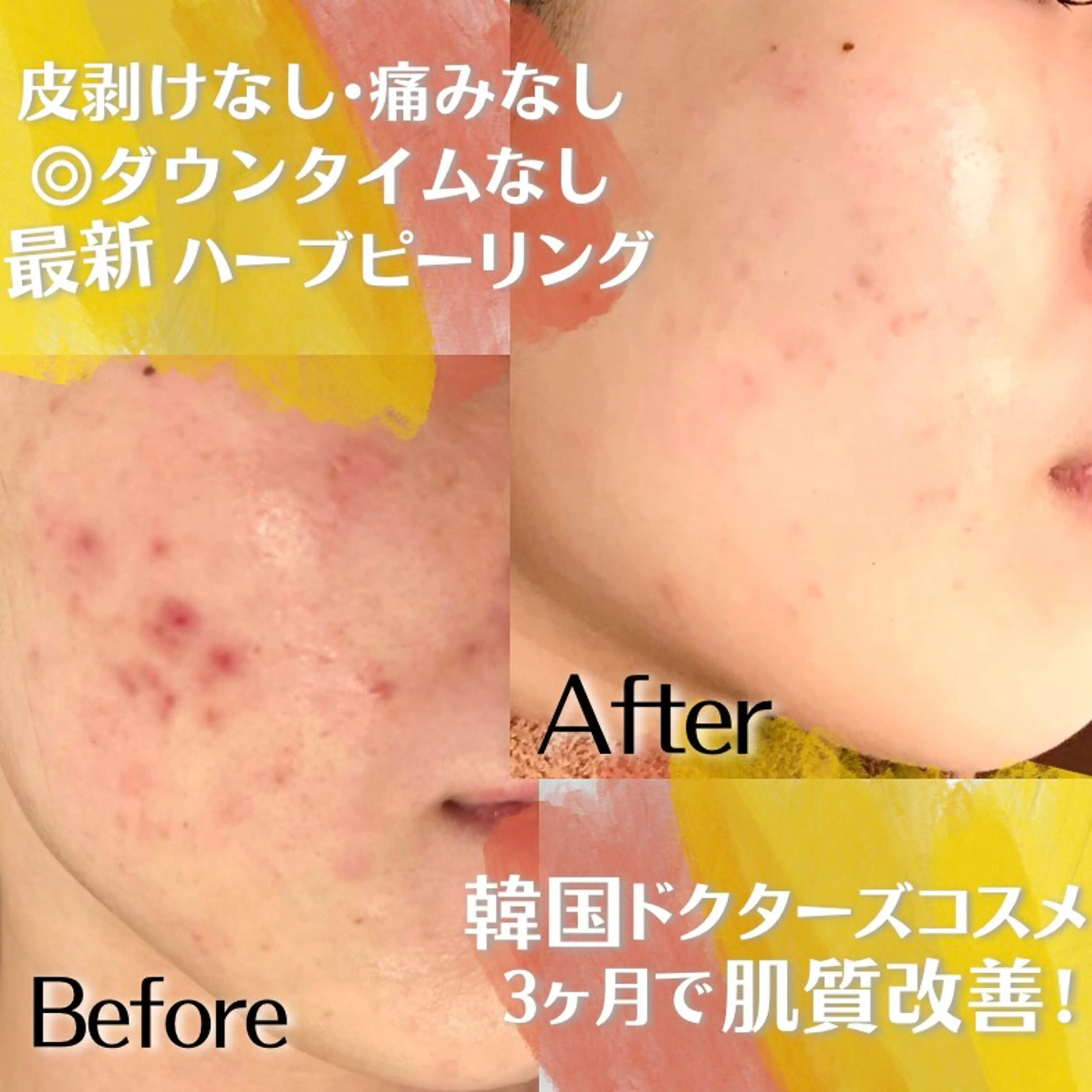 エステ 都度払い脱毛 BARNEYのエステ・リラクイメージ