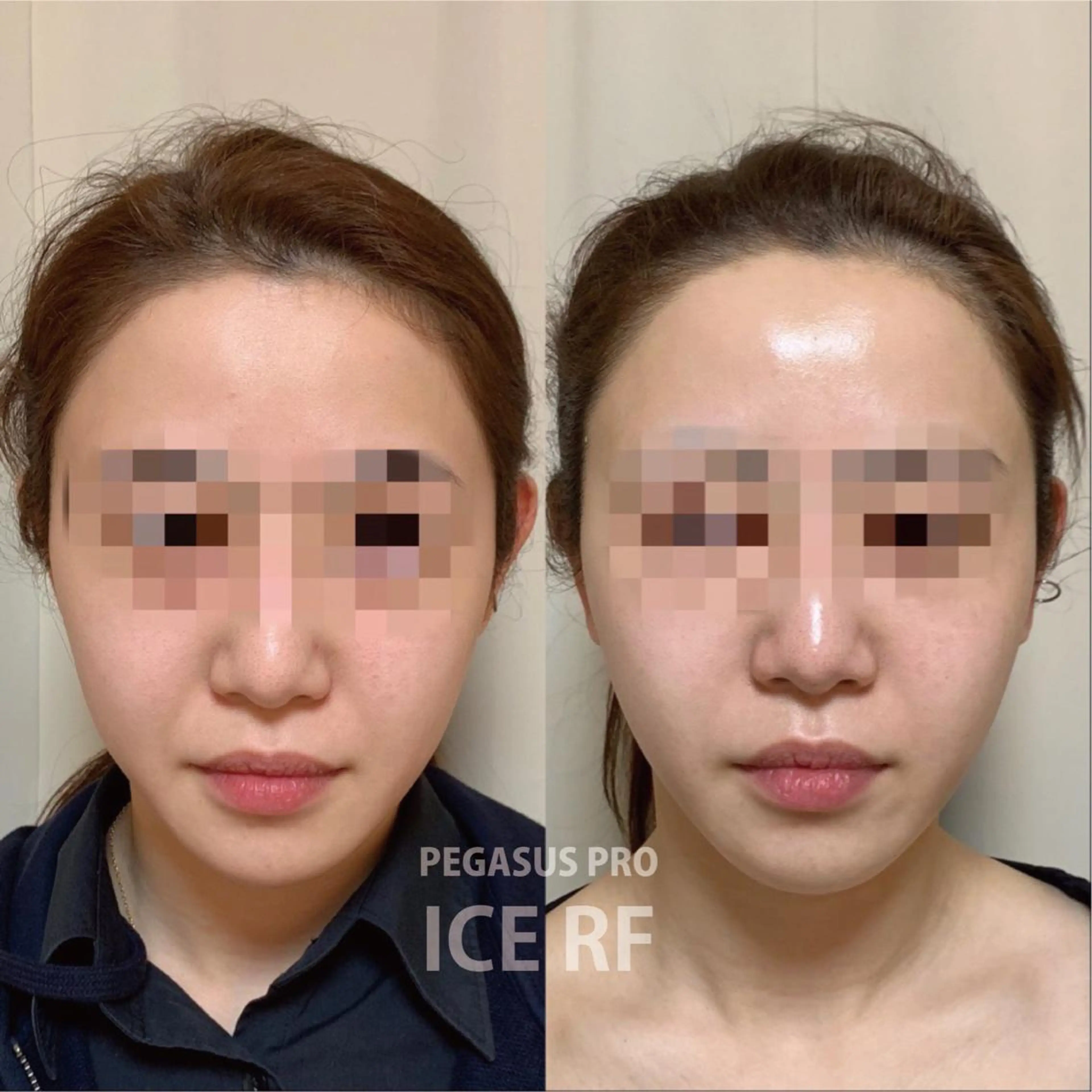 男女同額完全個室脱毛 LEPIA内田のエステ・リラクイメージ