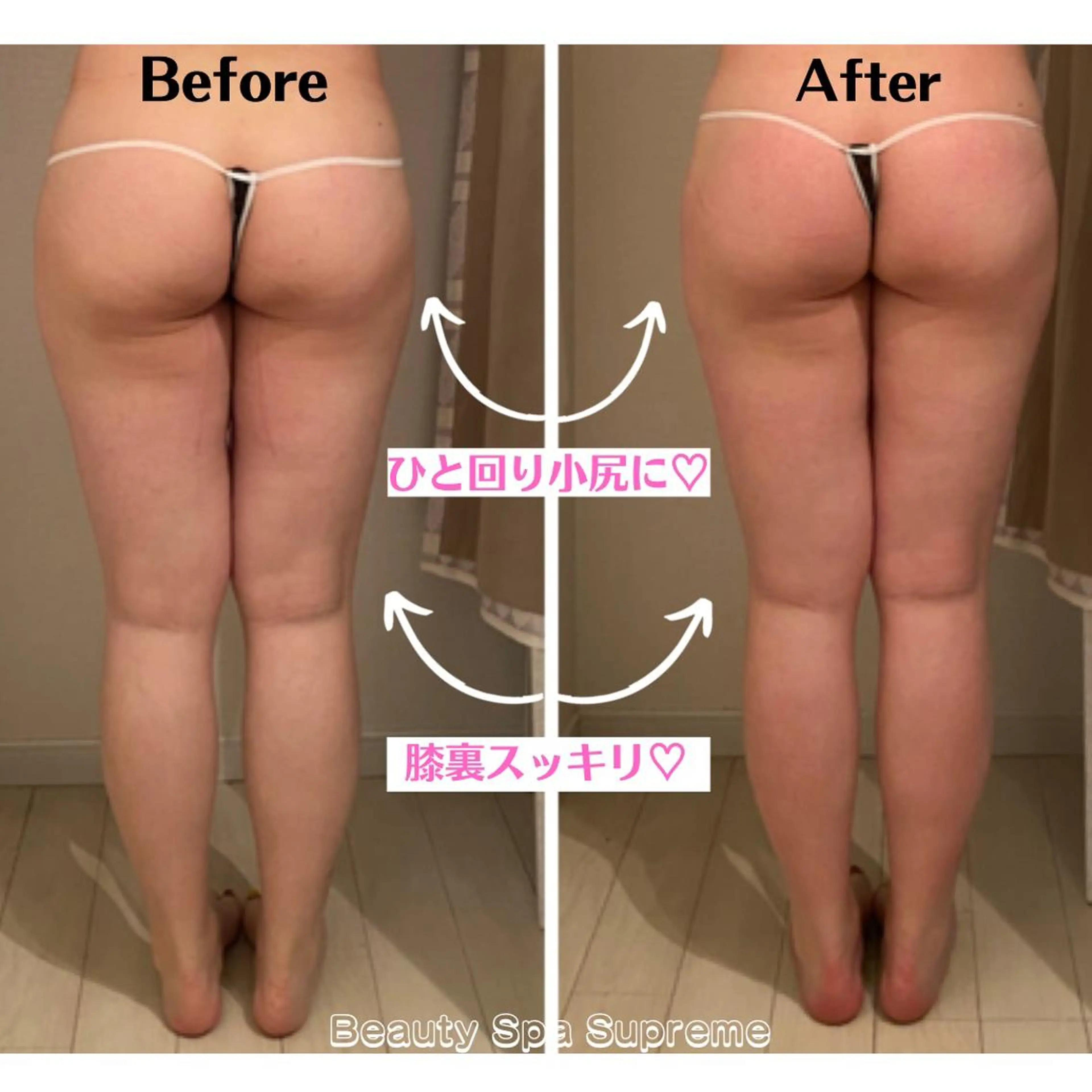 【深部までアプローチ:オールハンド】肩コリ＆浮腫み軽減⭐️リンパマッサージ60分の写真