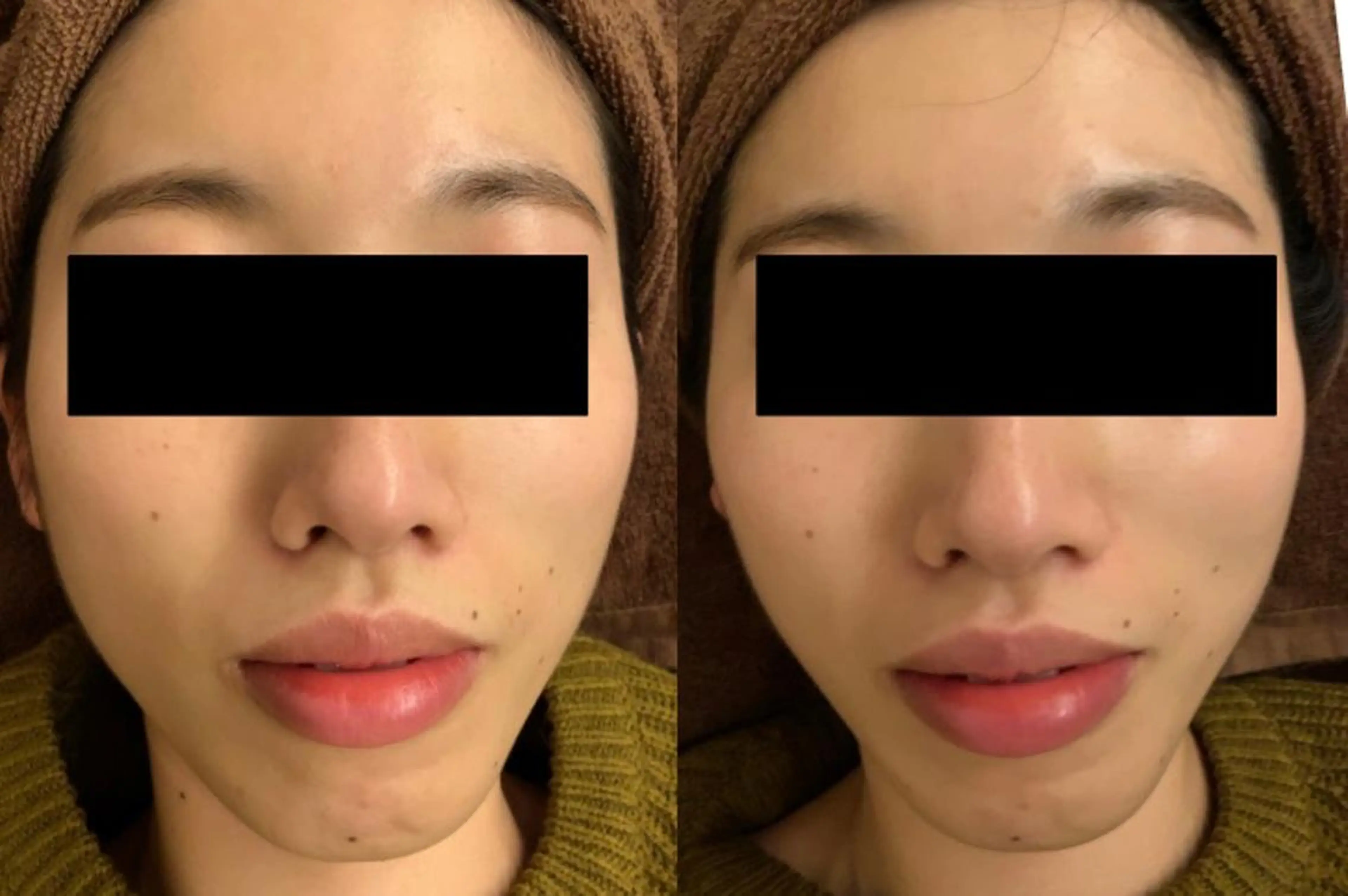 体質改善サロンCOTO所属・プライベートサロン COTOのエステ・リラクイメージ