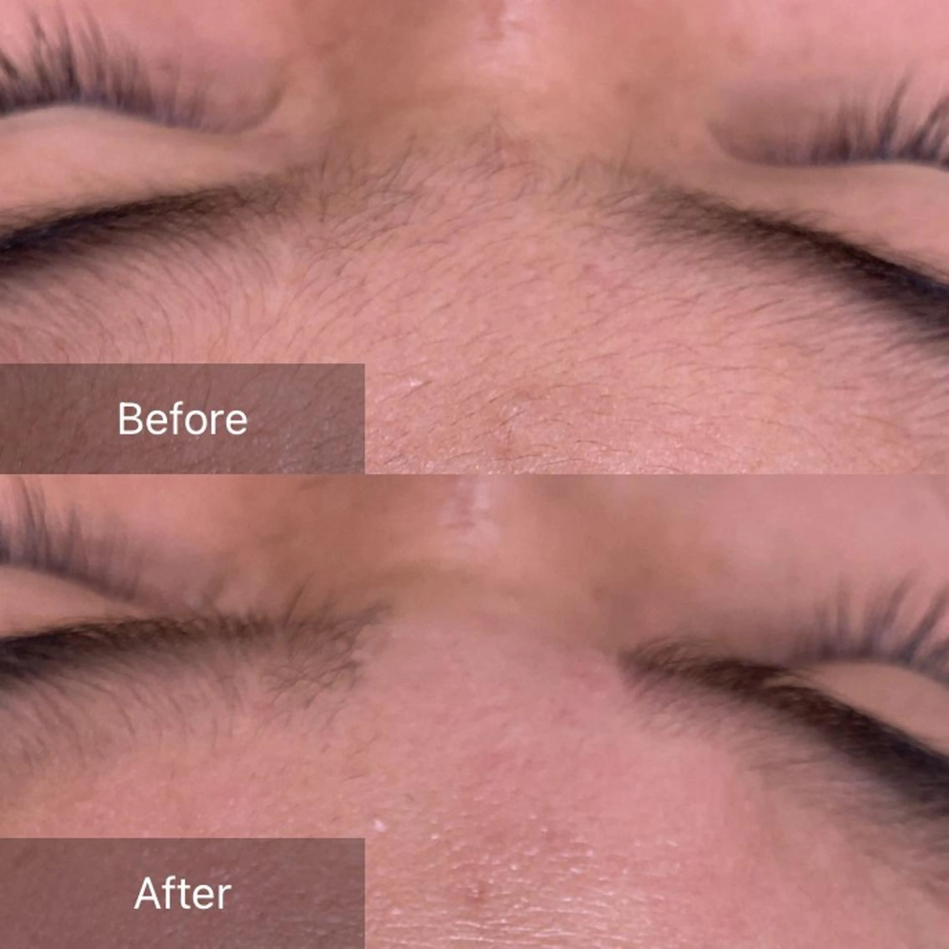 脱毛 産毛専門店 Bittoのエステ・リラクイメージ