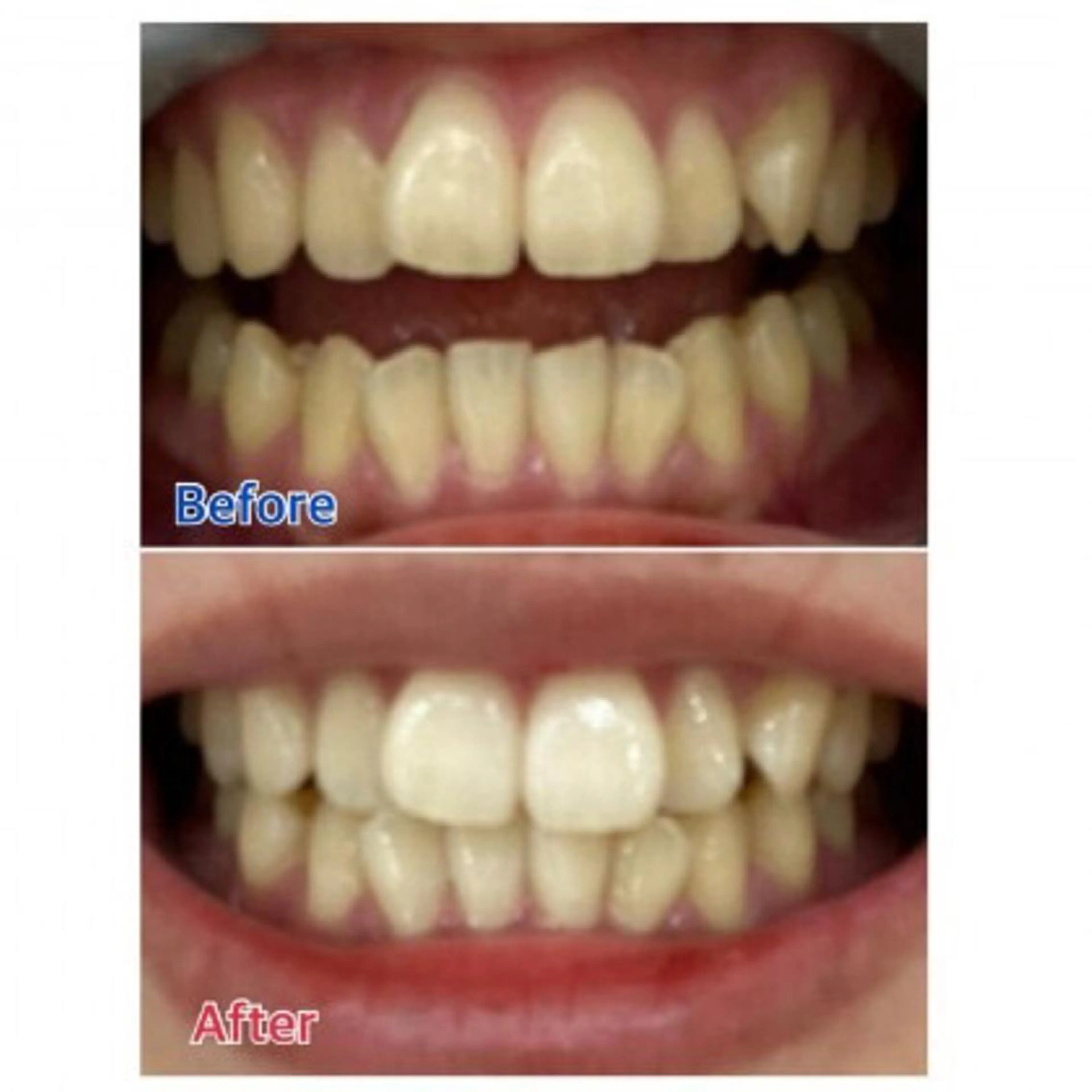 M渋谷店所属・Ｍ渋谷 ホワイトニングのエステ・リラクイメージ