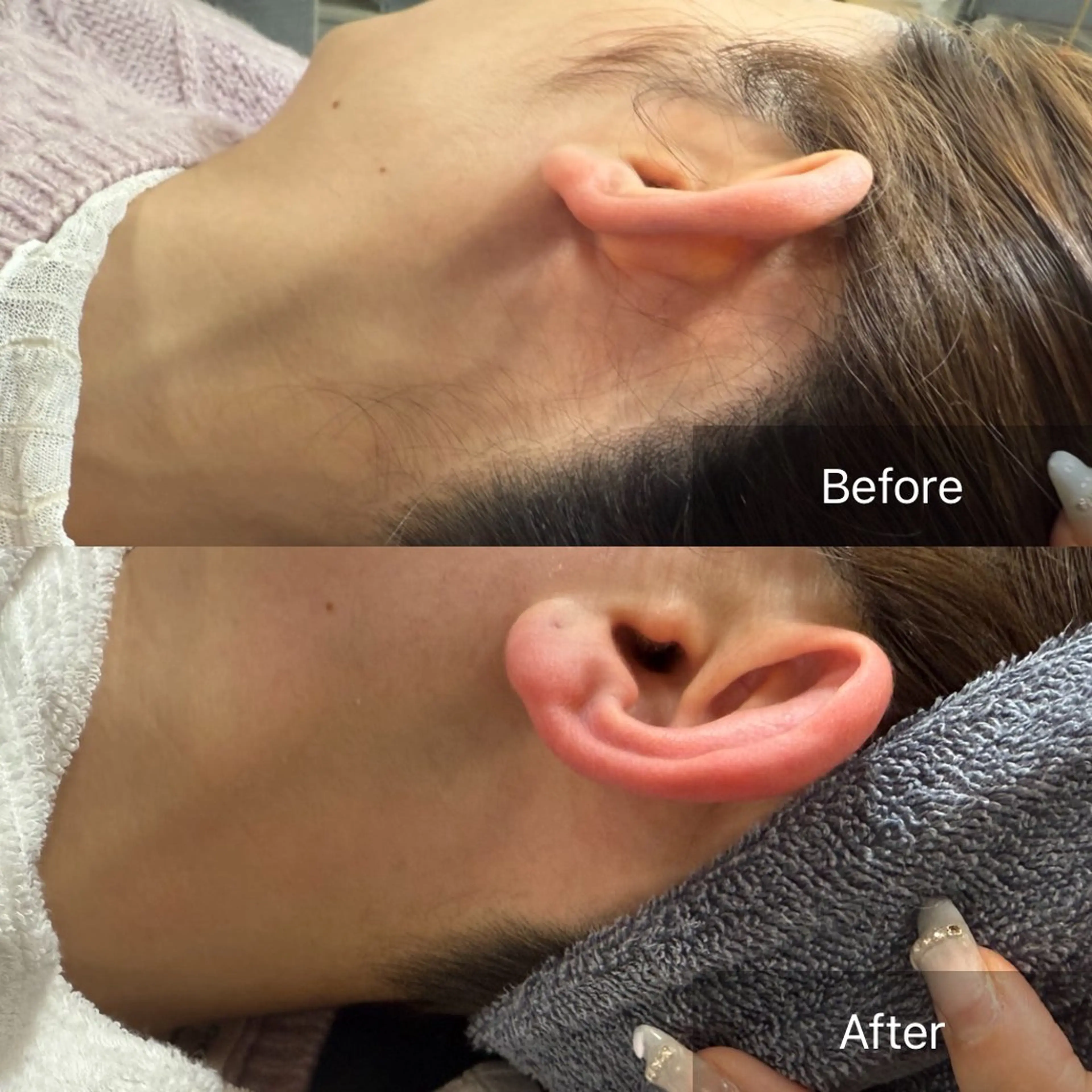 脱毛 enine所属・enine フェイスWAXのエステ・リラクイメージ