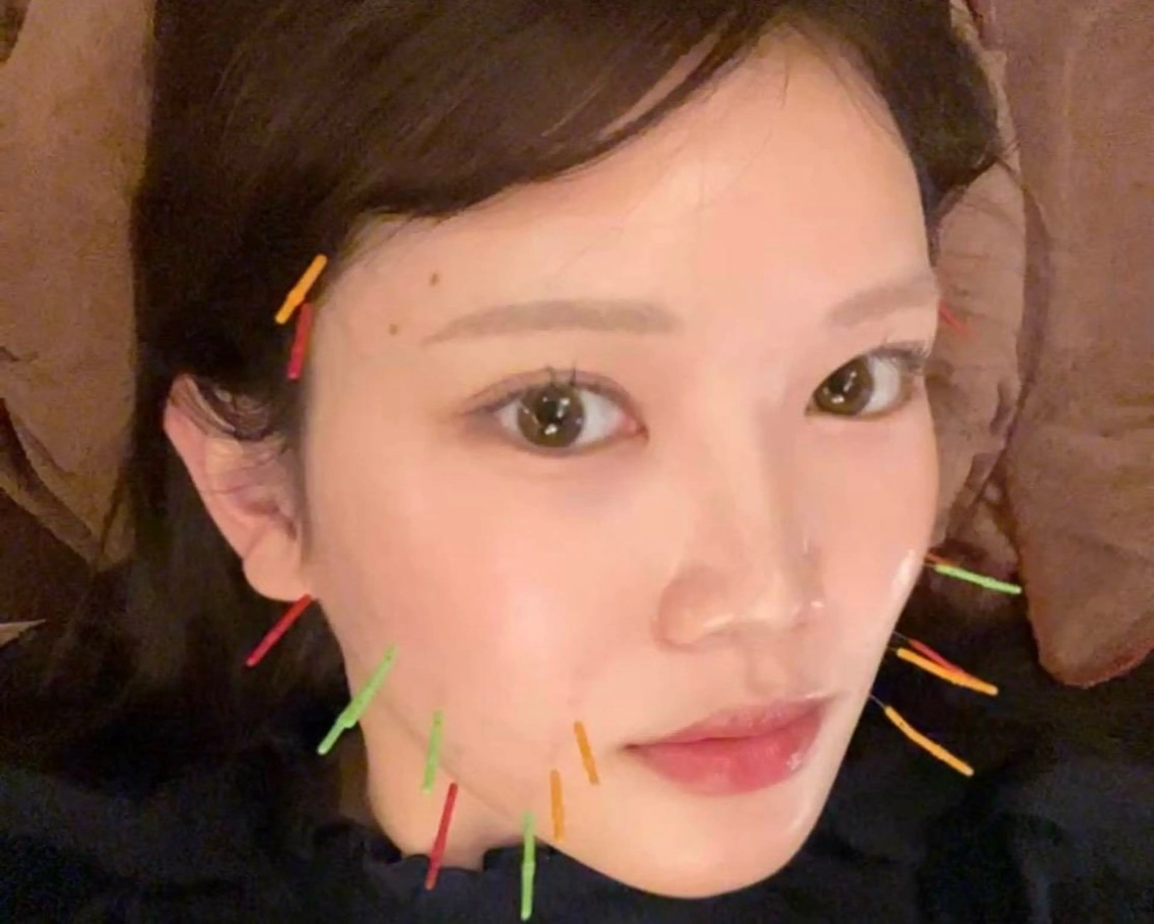 小顔鍼の練習モデル募集❣️むくみ・たるみを整え、フェイスラインすっきりを体感しませんか？初めての方大歓迎です✨の写真