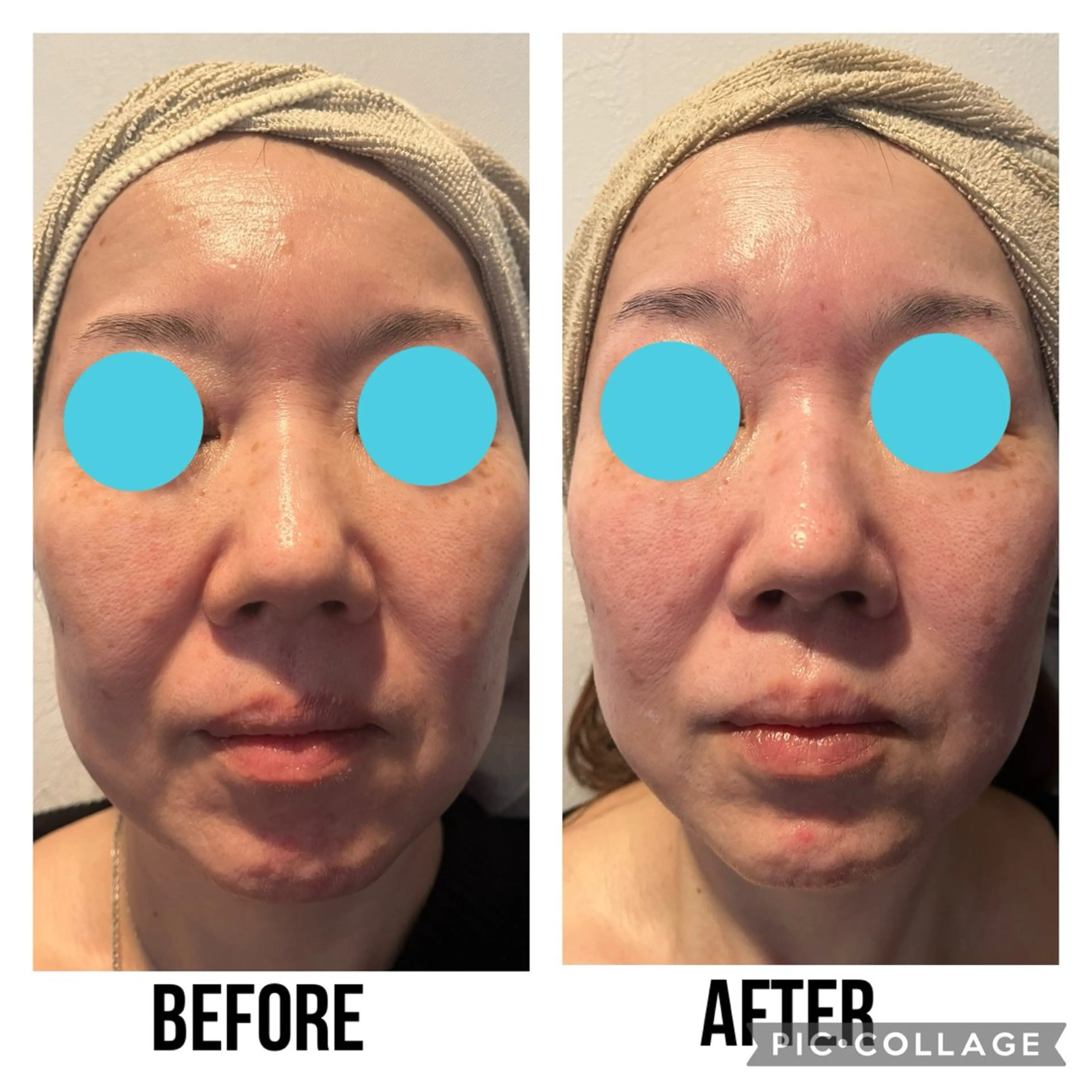 隠れ家フェイシャル&ドライヘッドケア新座所属・隠れ家フェイシャル＆ ドライヘッドケア新座のエステ・リラクイメージ