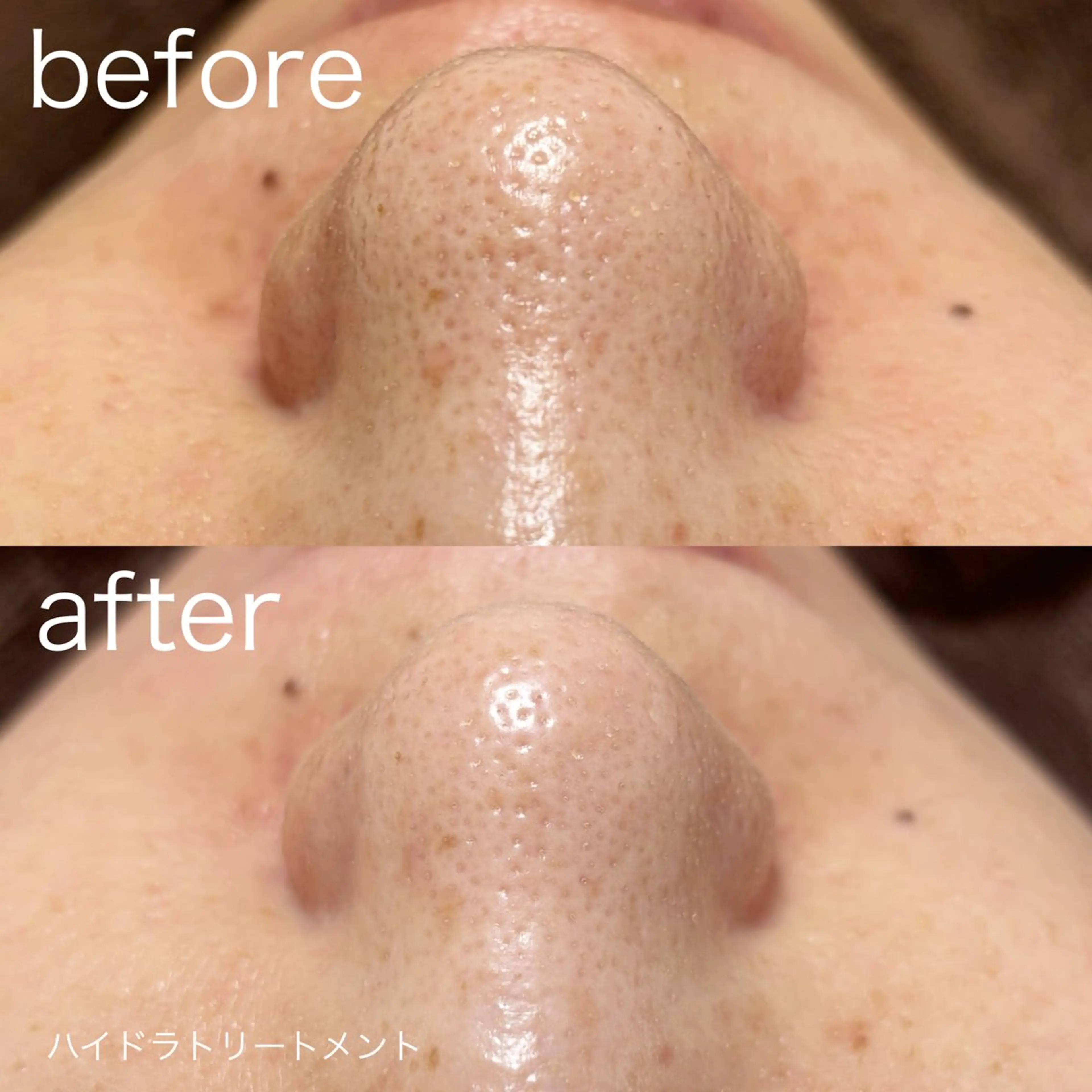 その他 lulularico Yuのエステ・リラクイメージ