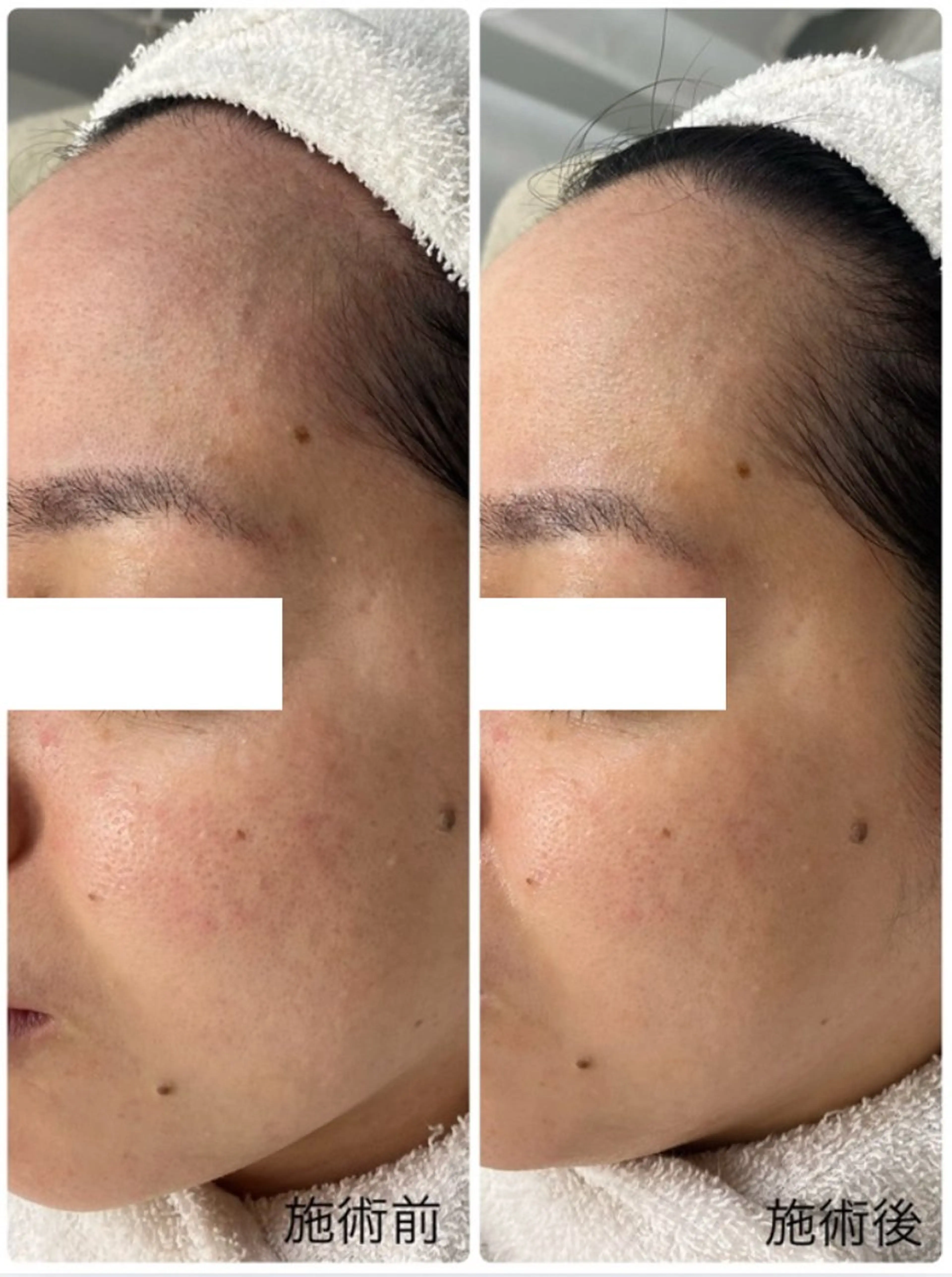 メンズ クリニカルWHITEケア豊見城所属・えだ すがこのエステ・リラクイメージ