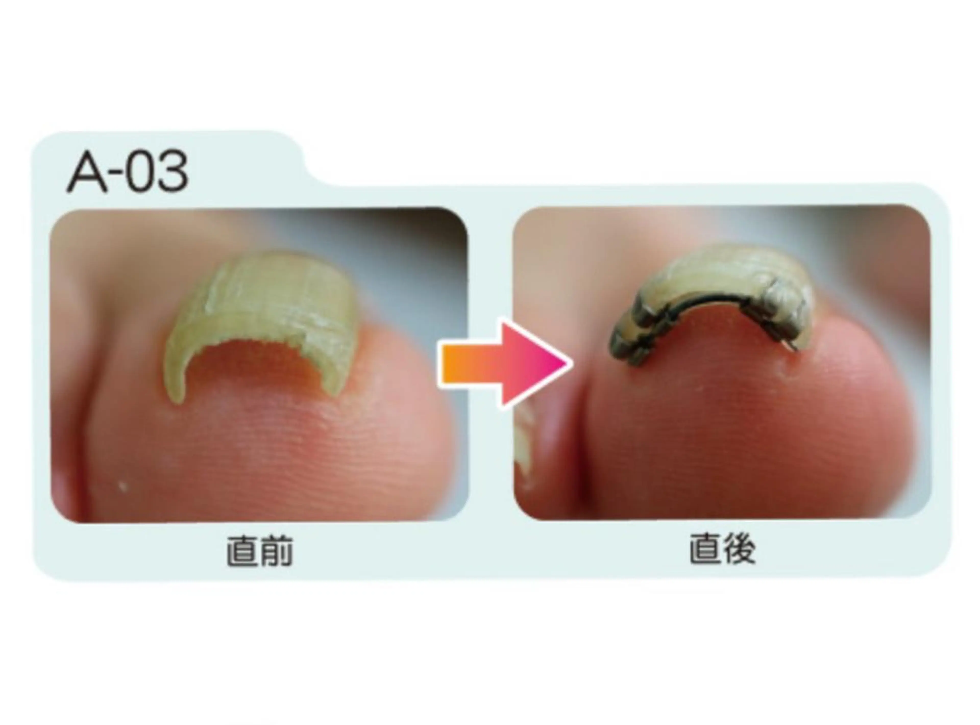 メンズ キッズ ネイル 🌱 ま し お 🌱のその他イメージ