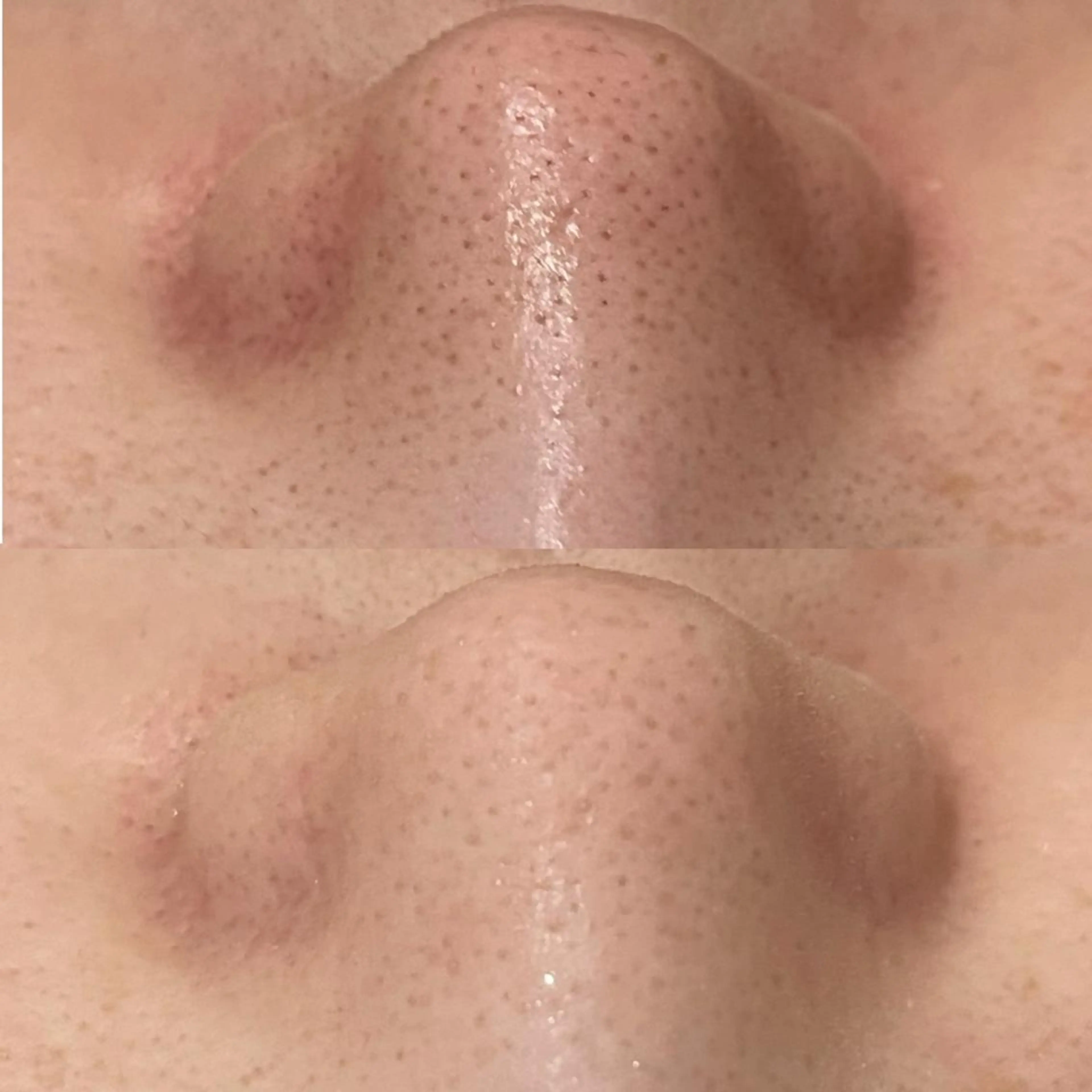 夏までに肌荒れ卒業 するサロン🌻のエステ・リラクイメージ