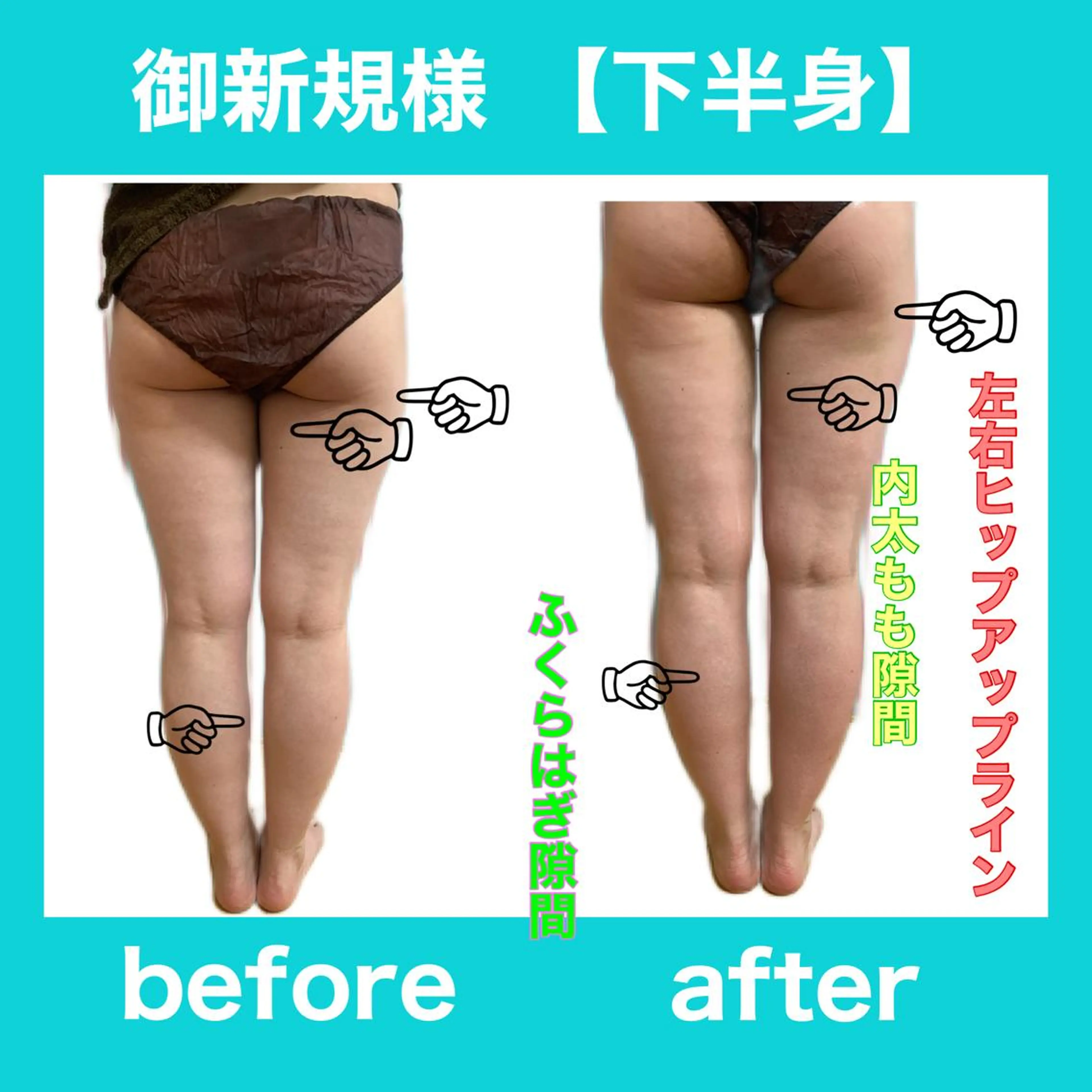 エステ リラク 痩身/脱毛/ネイル HARUKAのエステ・リラクイメージ