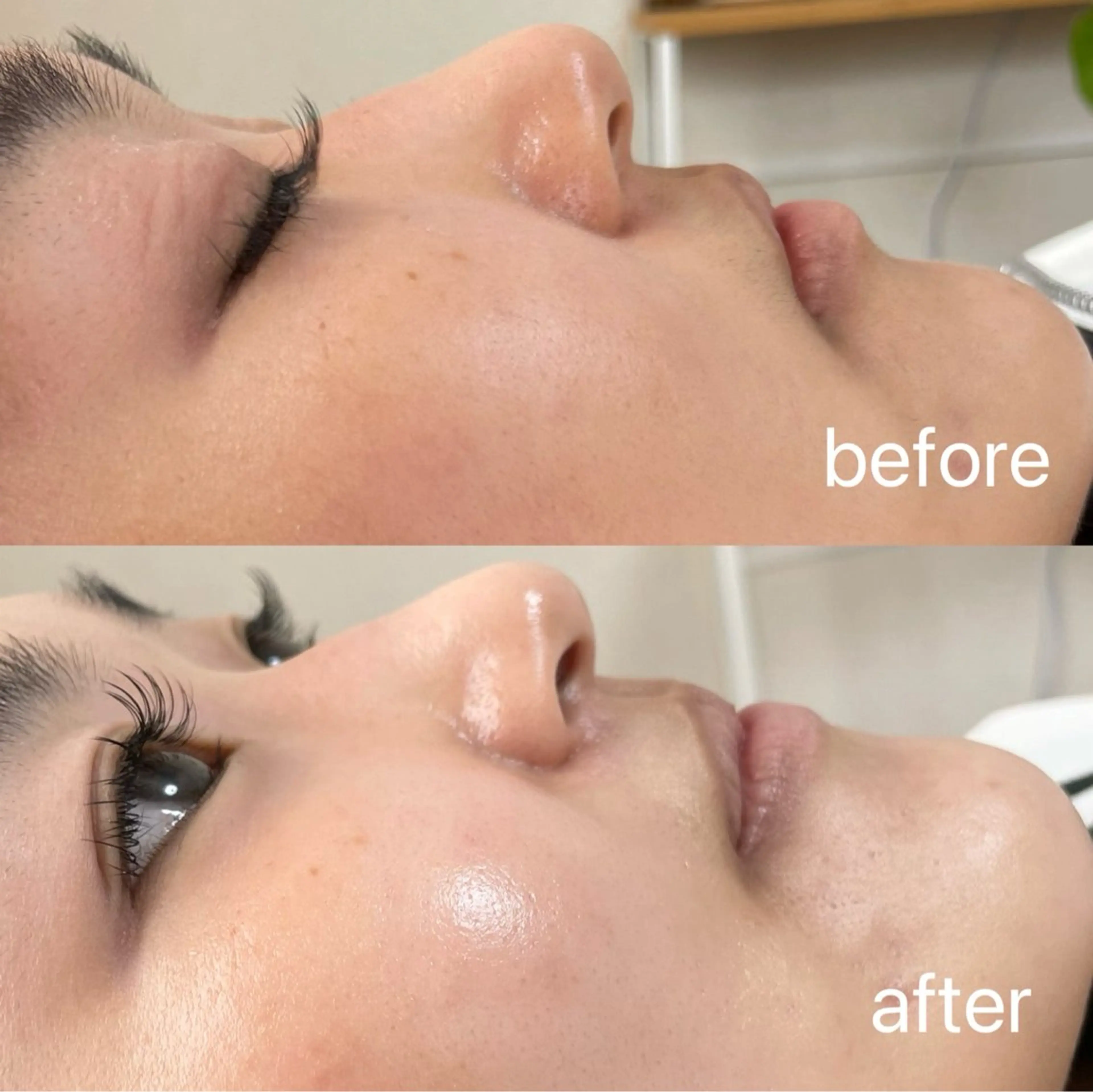 脱毛 まつげのお店 JUUL & LOUIS ｼﾞｭｰﾙｱﾝﾄﾞﾙｲｽ所属・JUUL&LOUIS 福藤 瞳のエステ・リラクイメージ