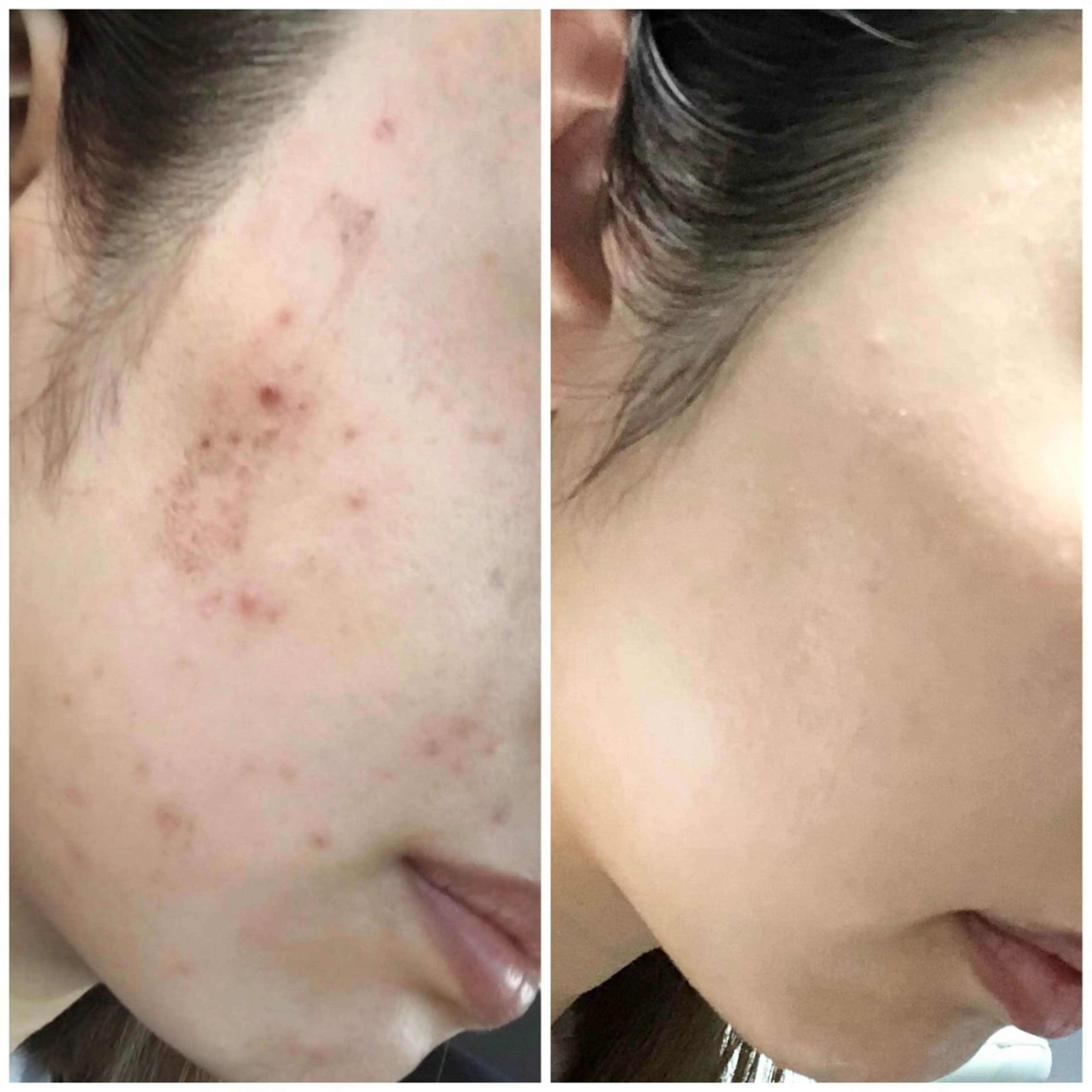 メンズ Na ( エヌエー )所属・Na natsumiのエステ・リラクイメージ