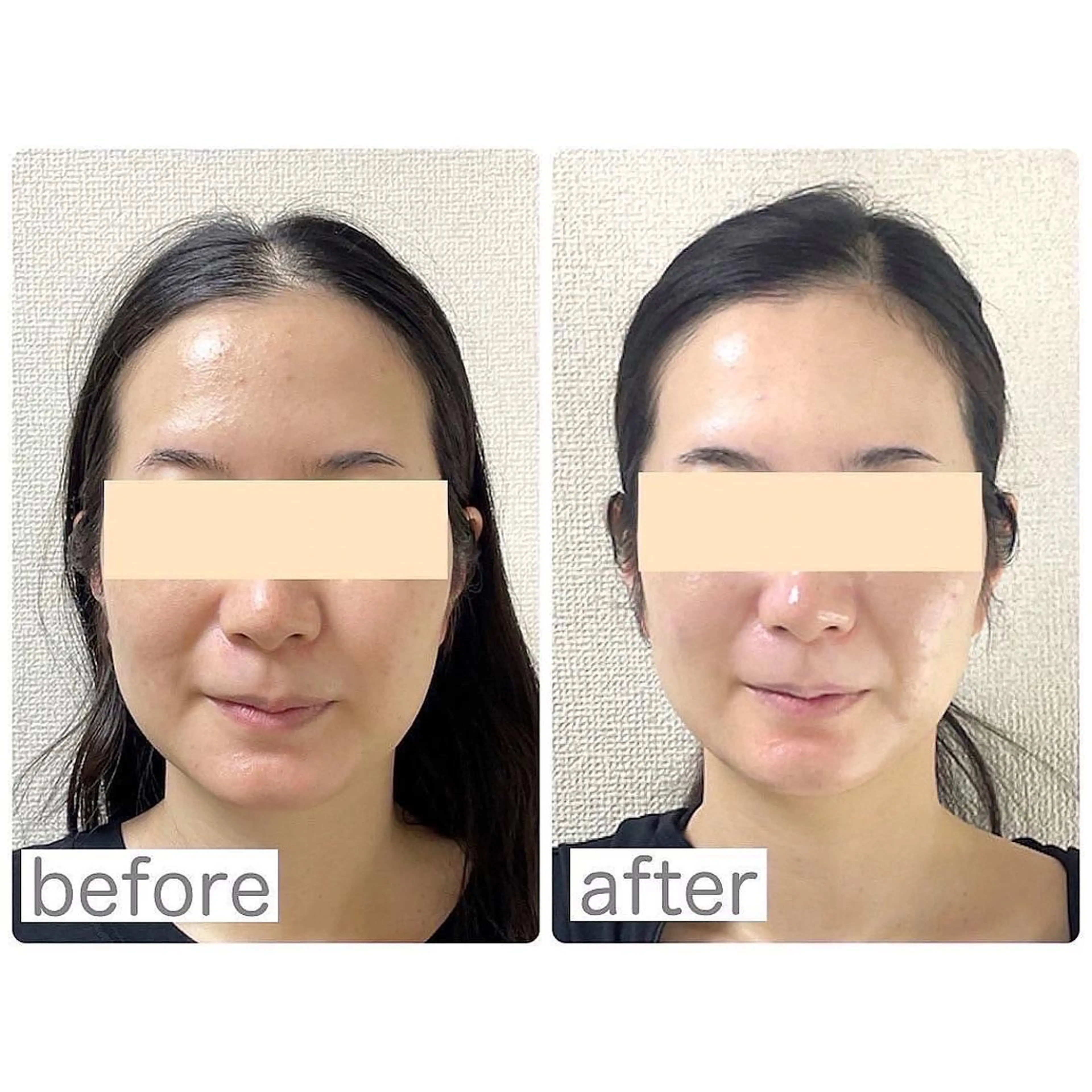 小顔矯正サロン　クレール所属・小顔矯正専門サロン クレールのエステ・リラクイメージ