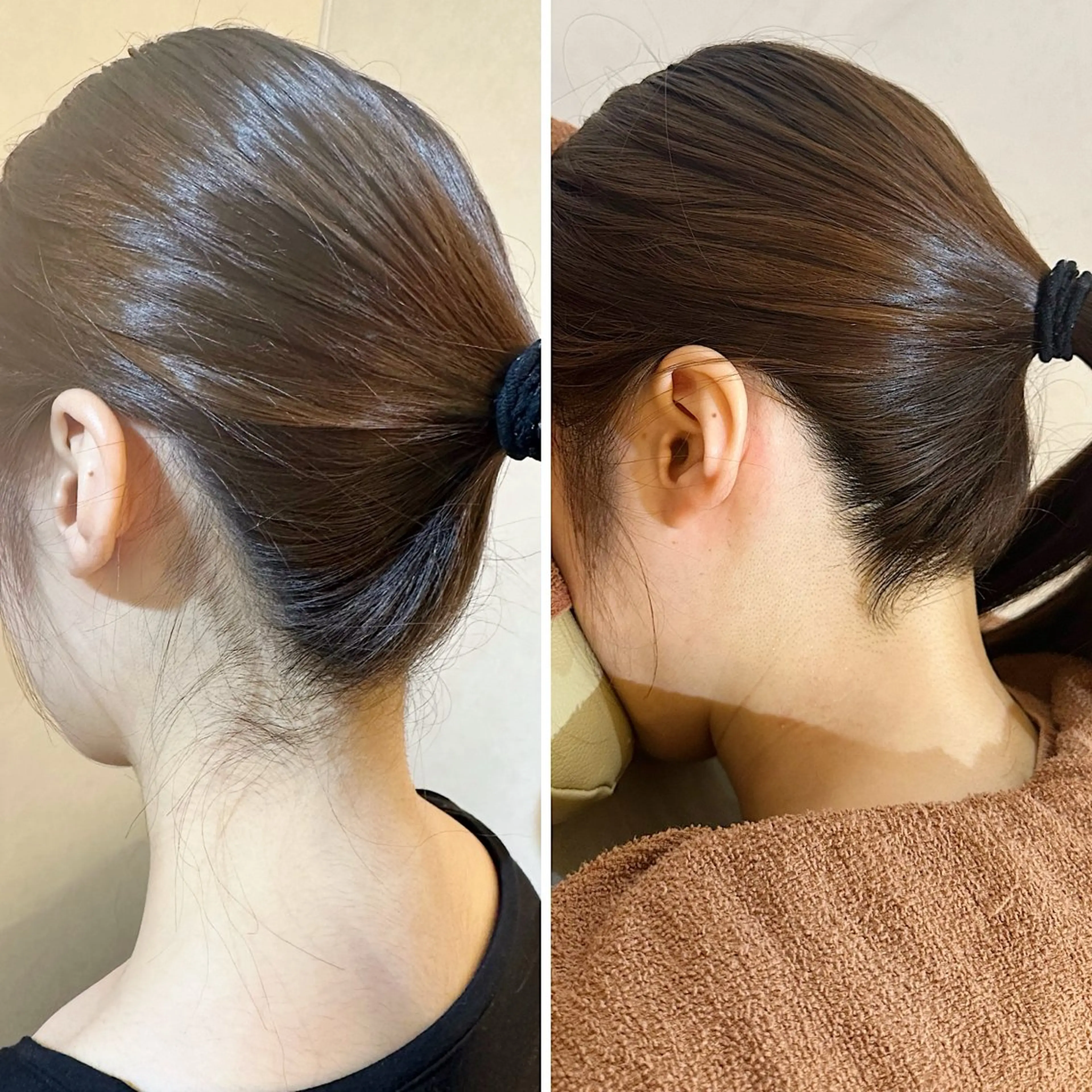 うなじ脱毛/美肌脱毛 LABELのエステ・リラクイメージ