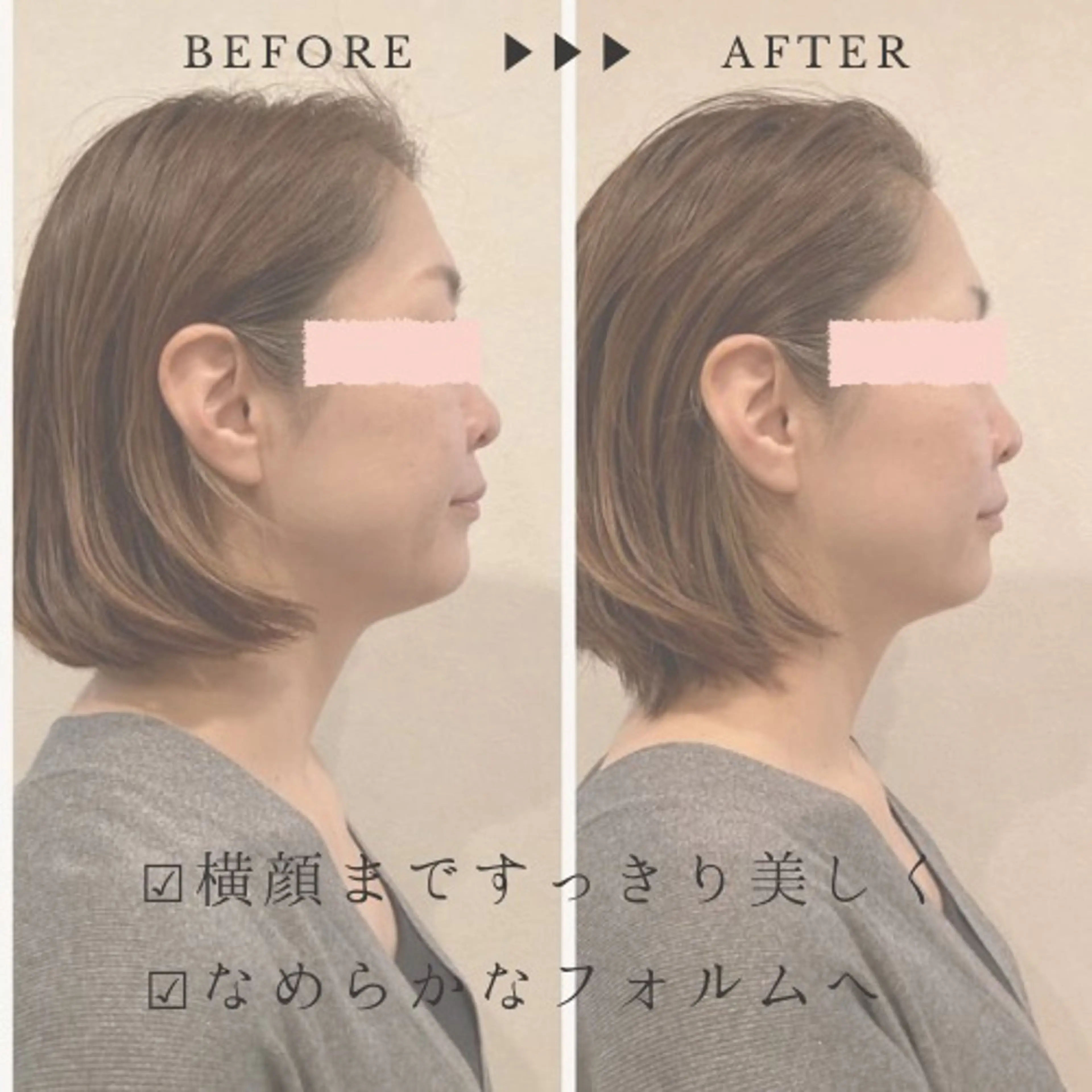 エステ リラク 小顔×肌質改善サロン soin〔ソワン〕のエステ・リラクイメージ