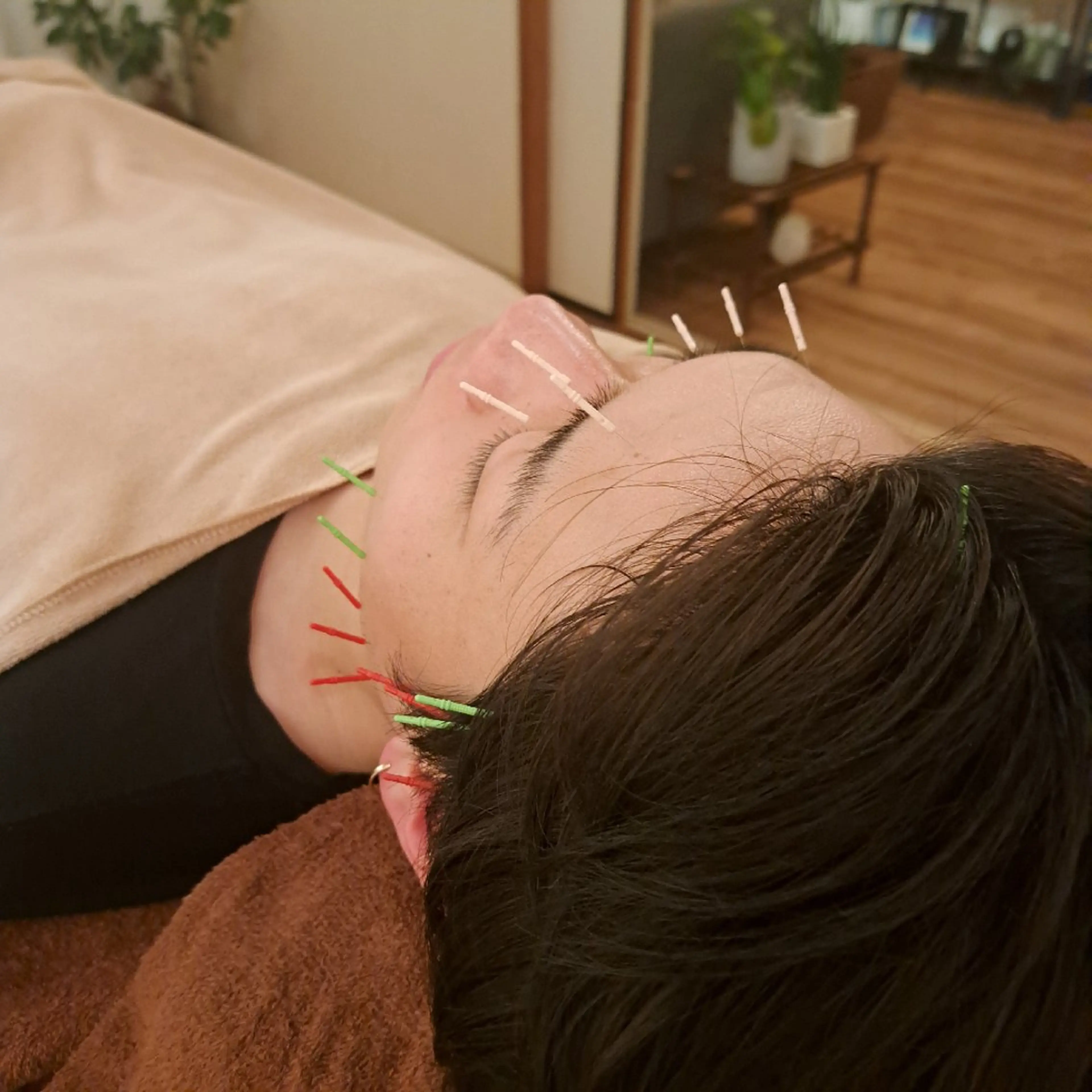 鍼灸サロンmiyabi所属・美容鍼×エステ　鍼灸 サロンmiyabiのエステ・リラクイメージ