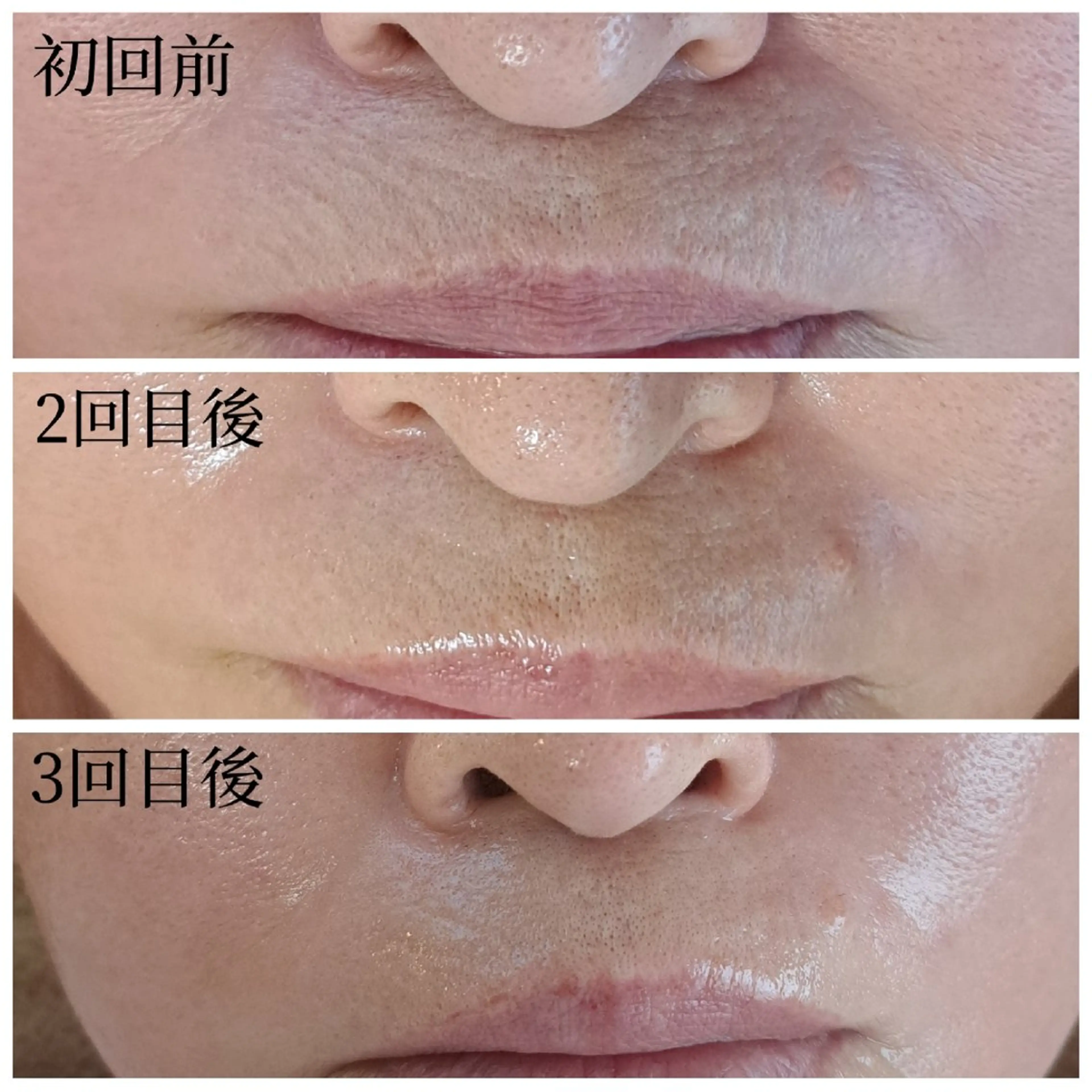 エステ Salon de  HiAのエステ・リラクイメージ