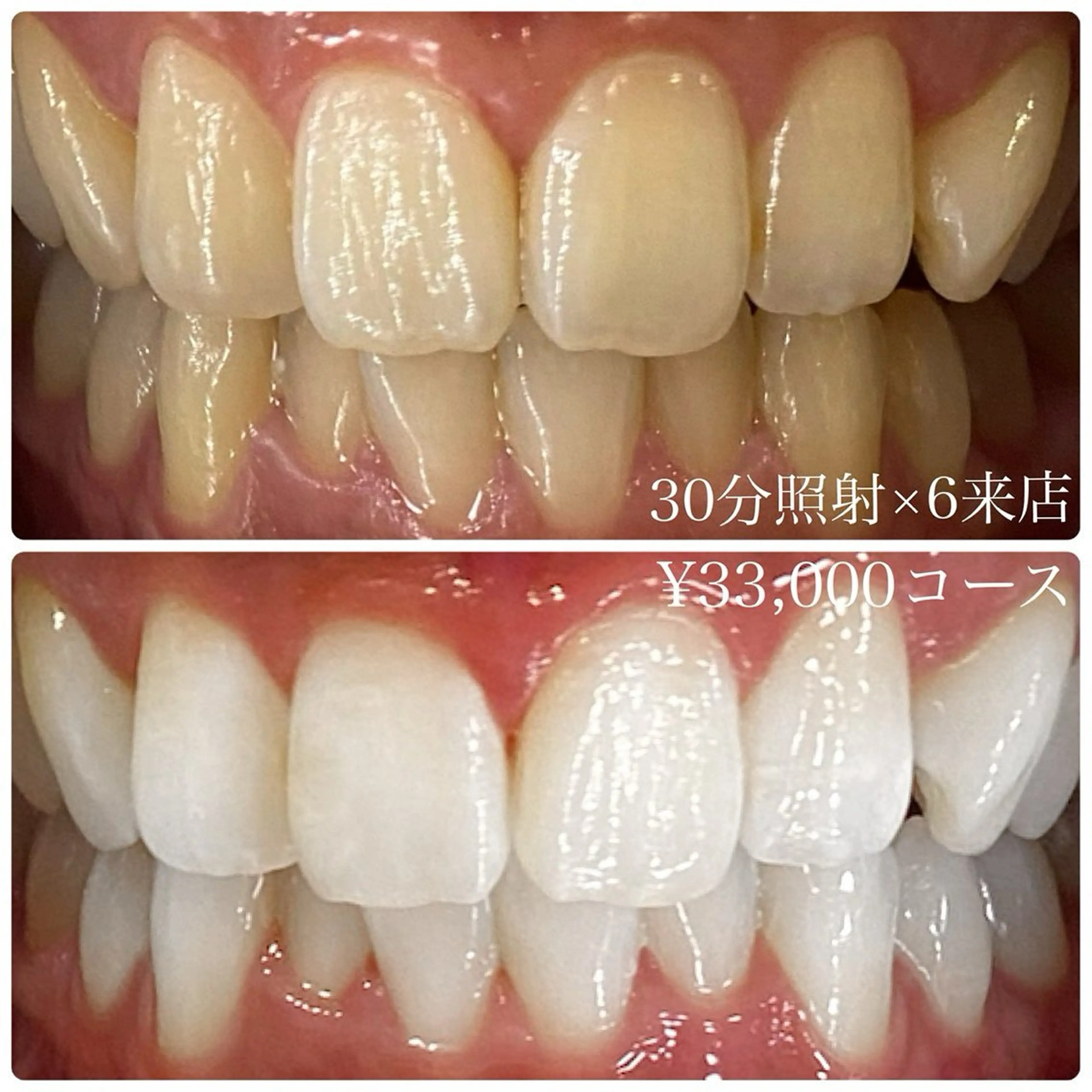 その他 PLATINUM Beauty 横浜店所属・ホワイトニングルーム 横浜店のその他イメージ