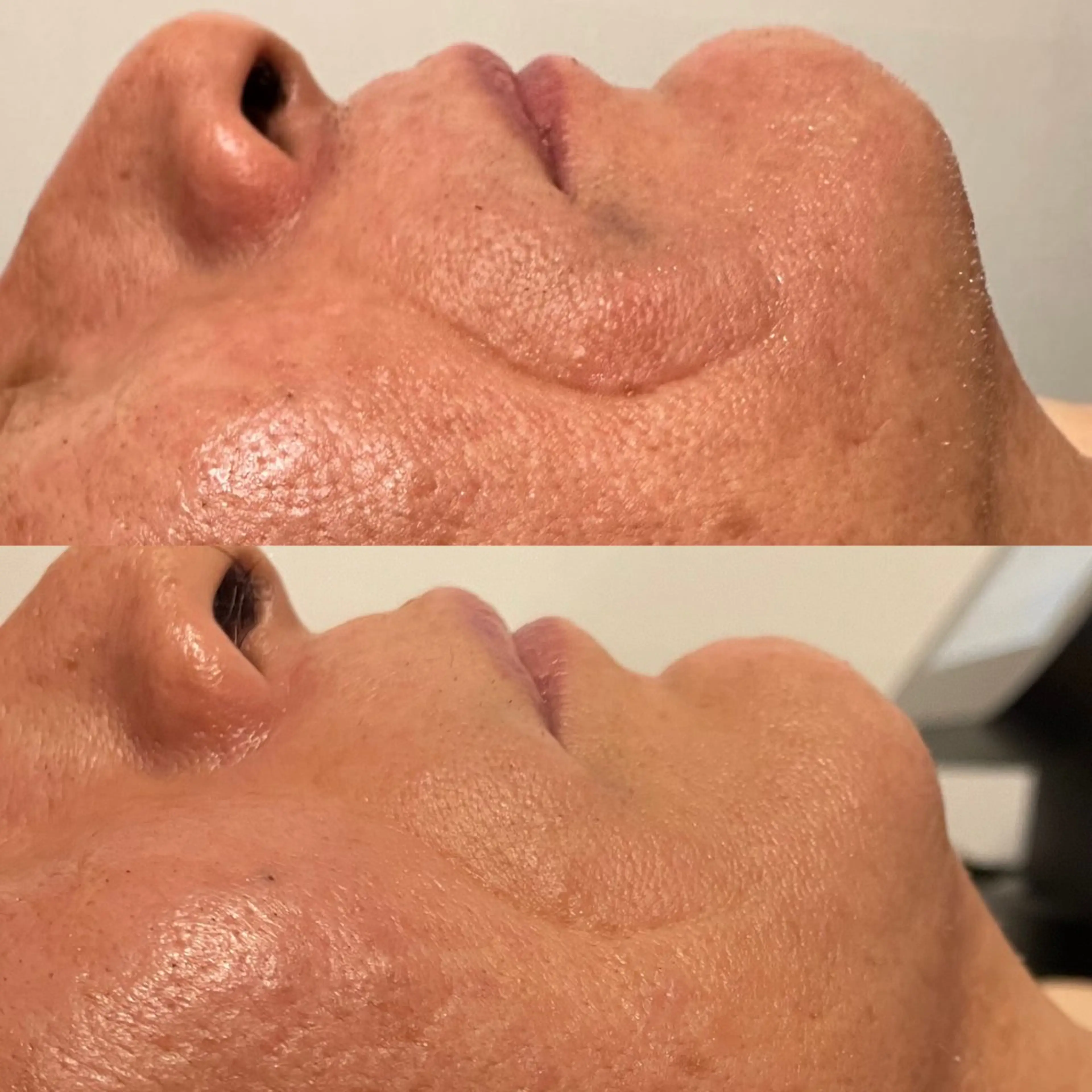 セルフエステエンリケ明石大久保店所属・夕希リンパ&痩身& 脱毛&毛穴ケアのエステ・リラクイメージ