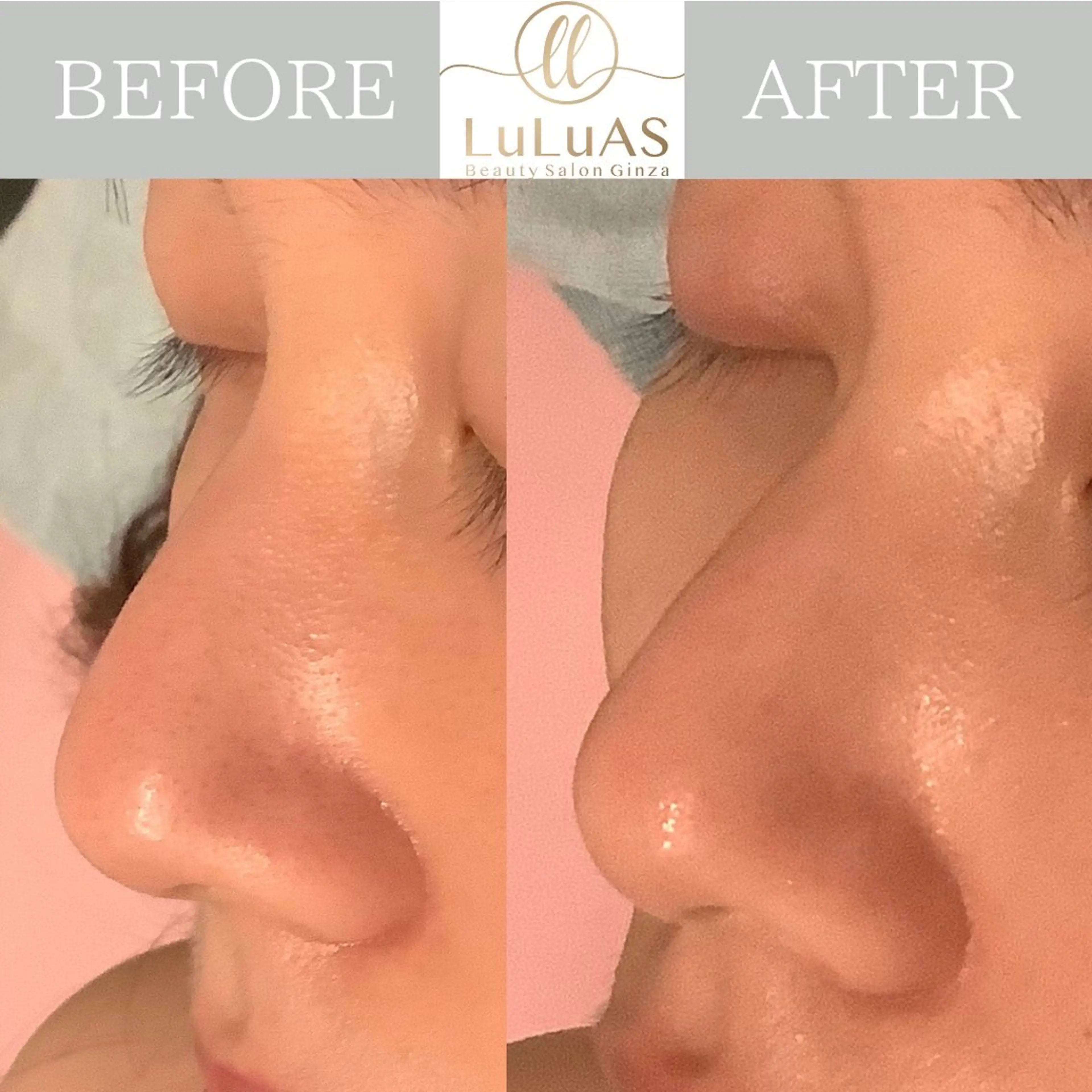 エステ リラク ルルアス GINZAのエステ・リラクイメージ