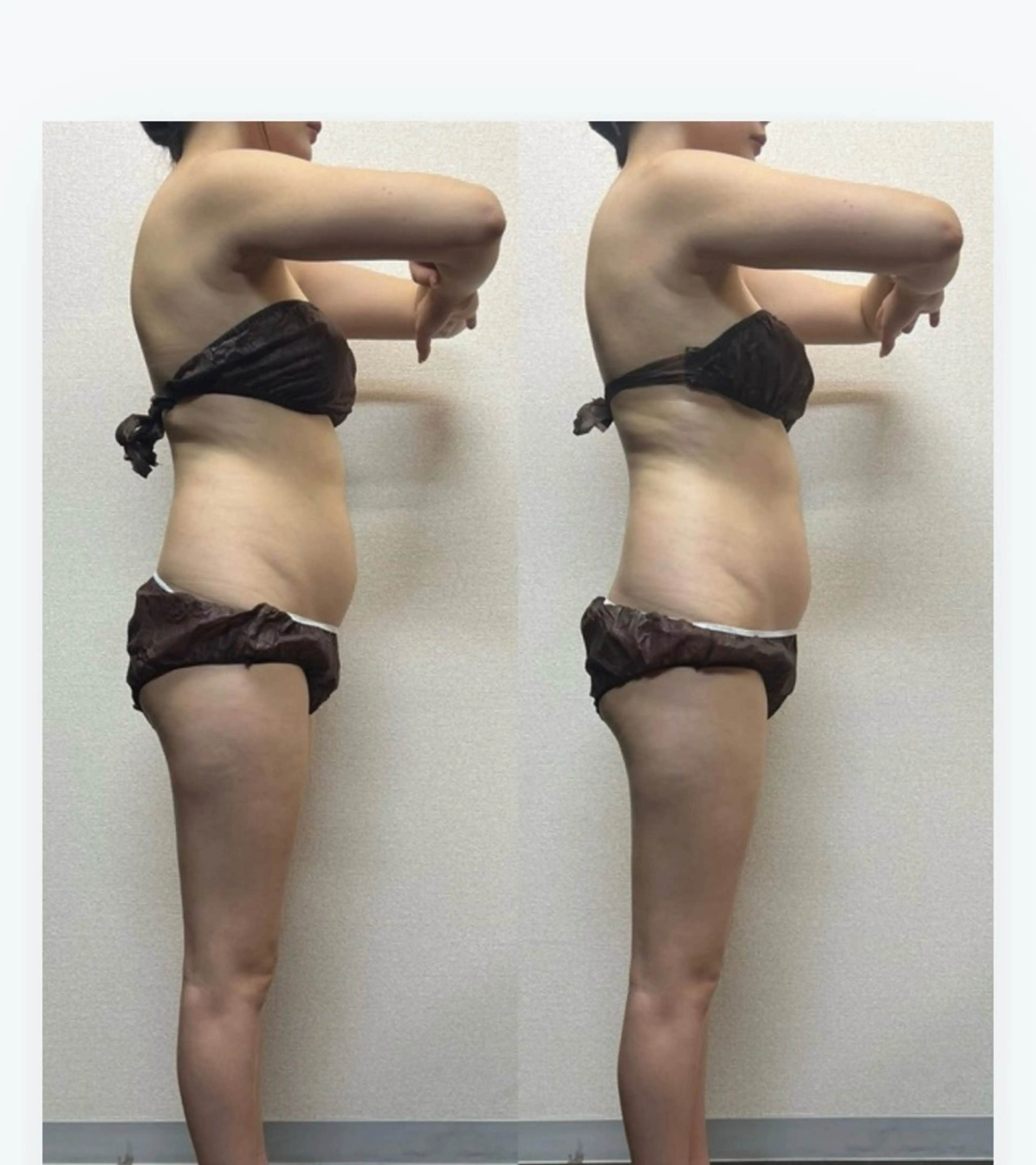 ハイパーナイフ専門店　Salon de COCO所属・Salon de COCOのエステ・リラクイメージ